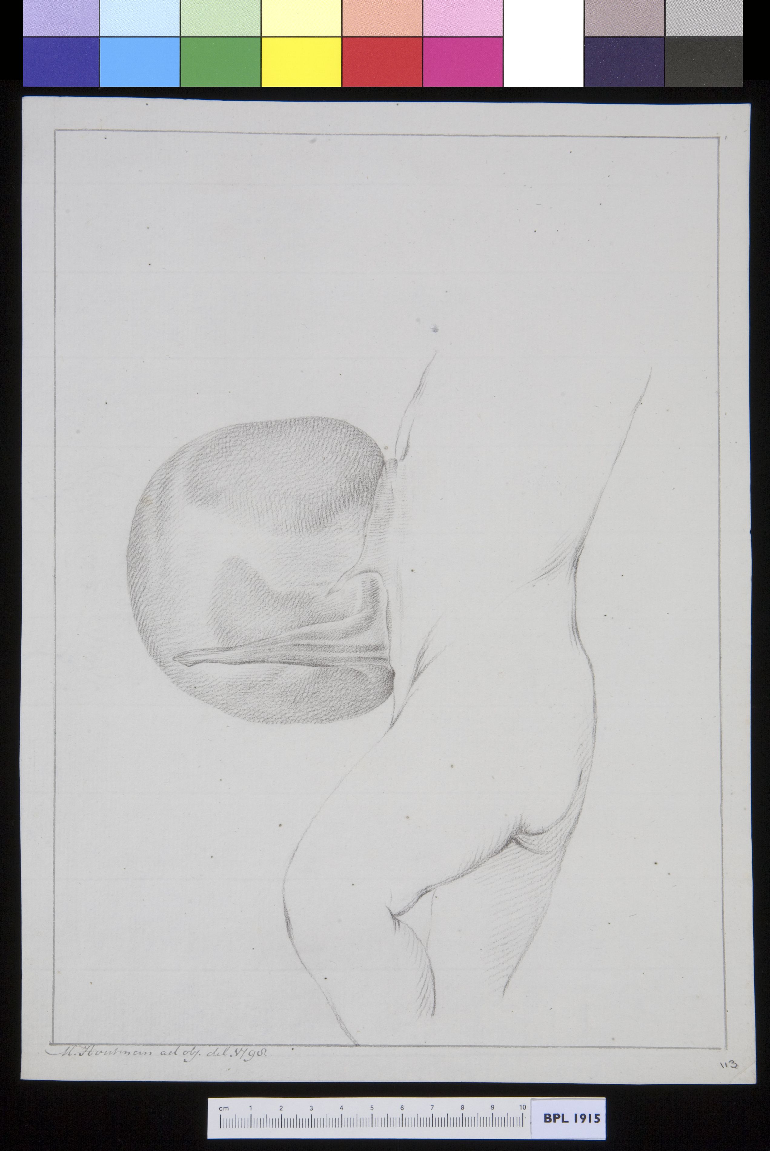 Hernia on a child's body