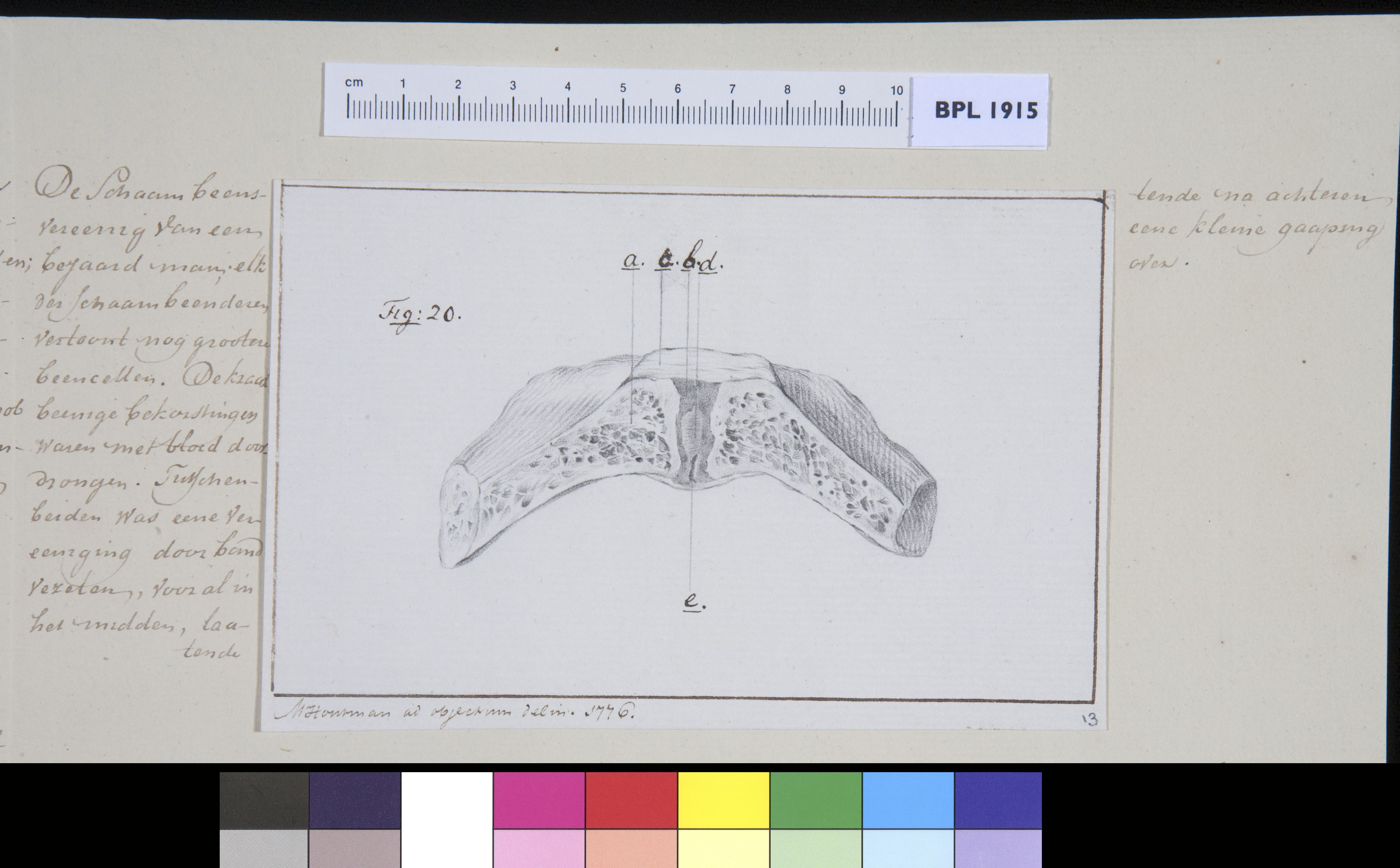 Pubis bone