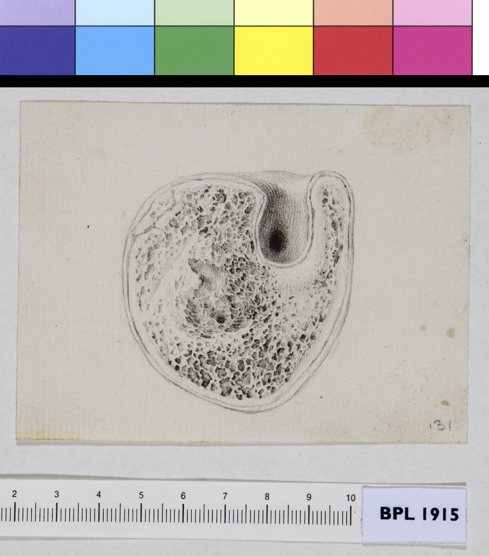 Bone: cross section