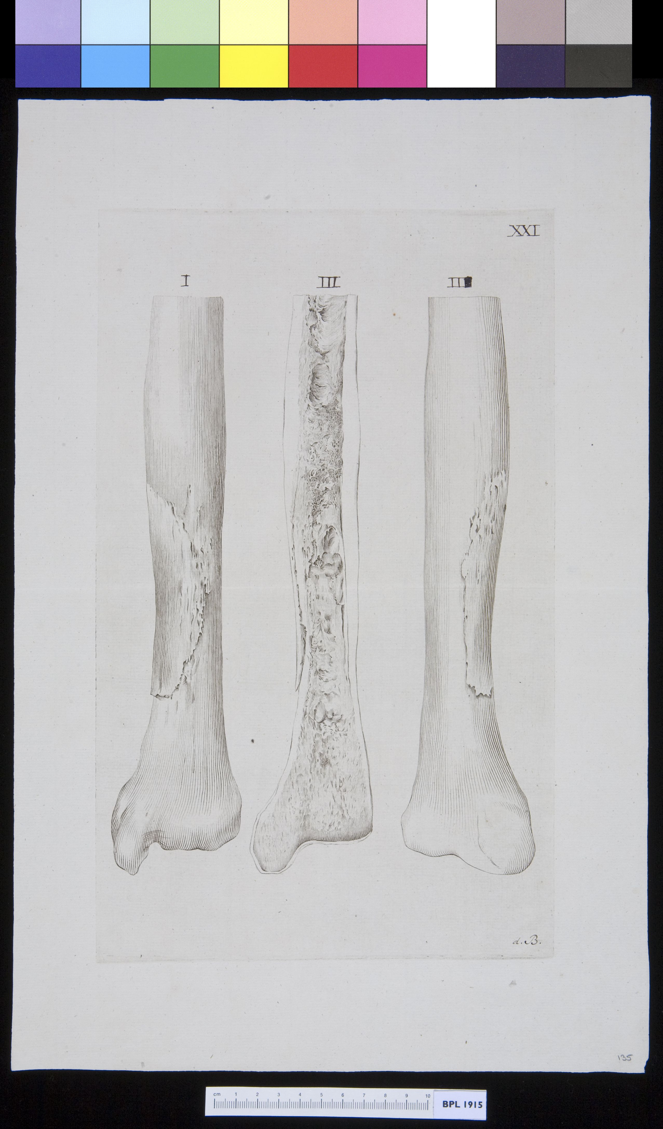 Several views of an infected bone
