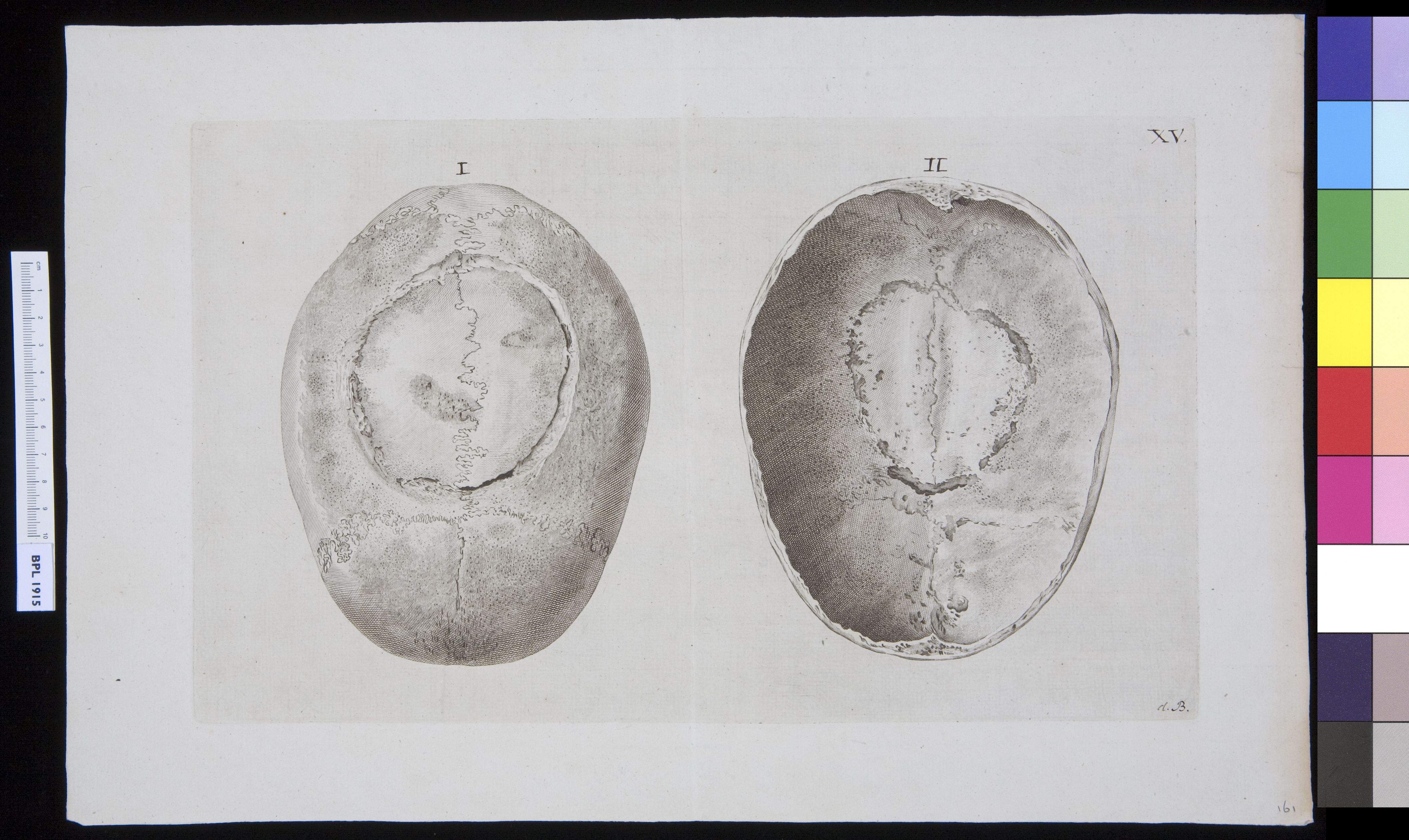 Skull, parietal and frontal, interior and exterior view