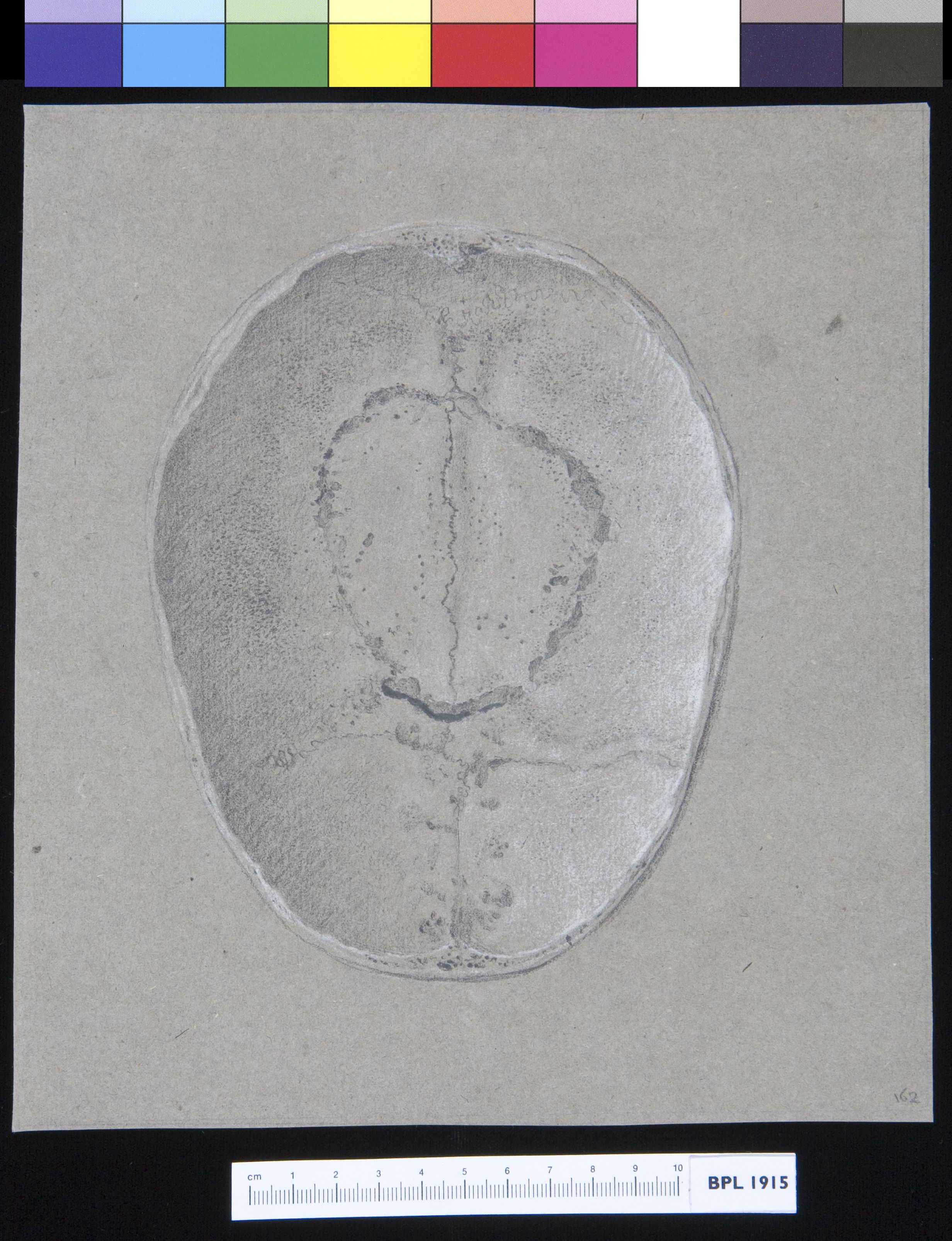 Skull, parietal and frontal, interior view