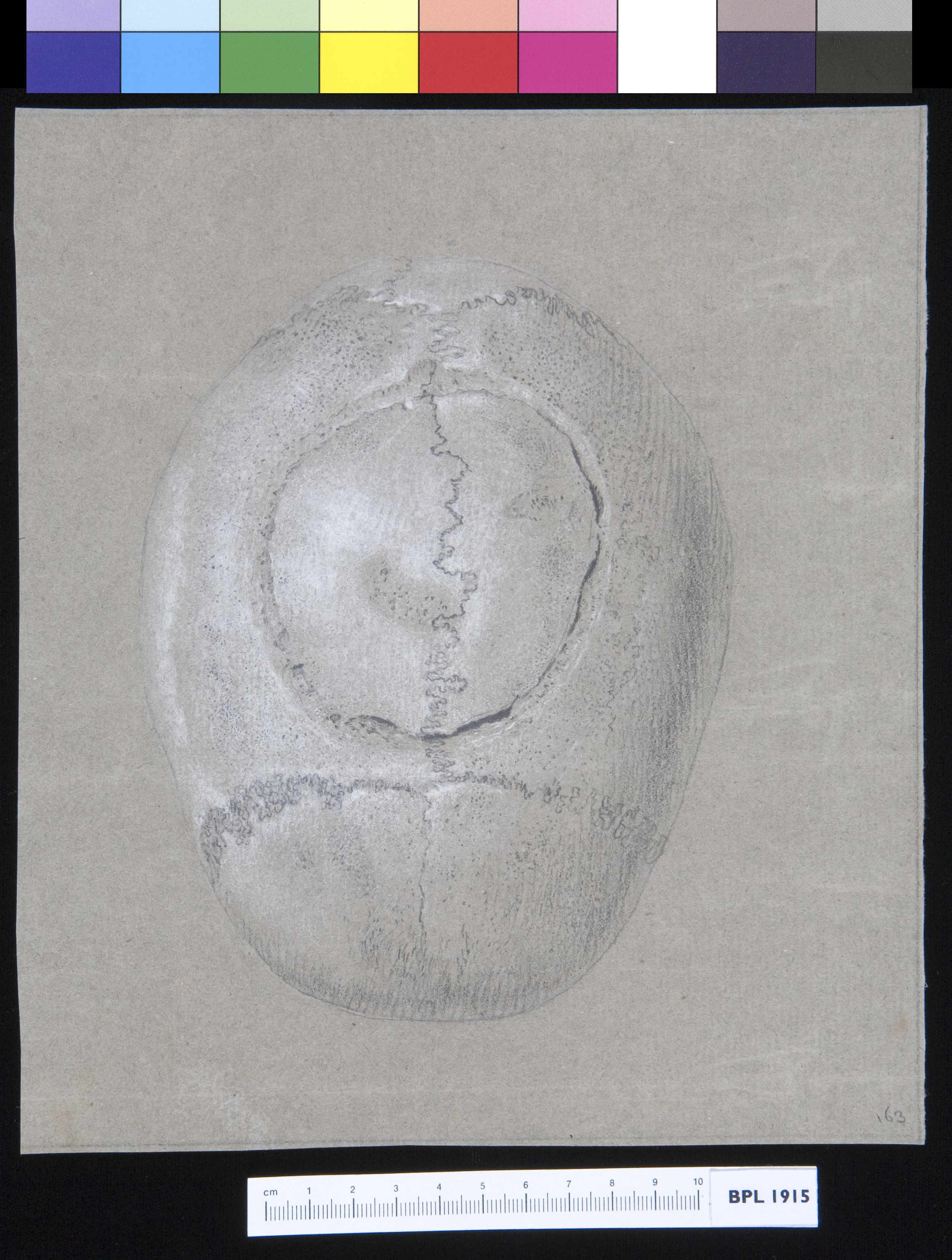 Skull, parietal and frontal, exterior view