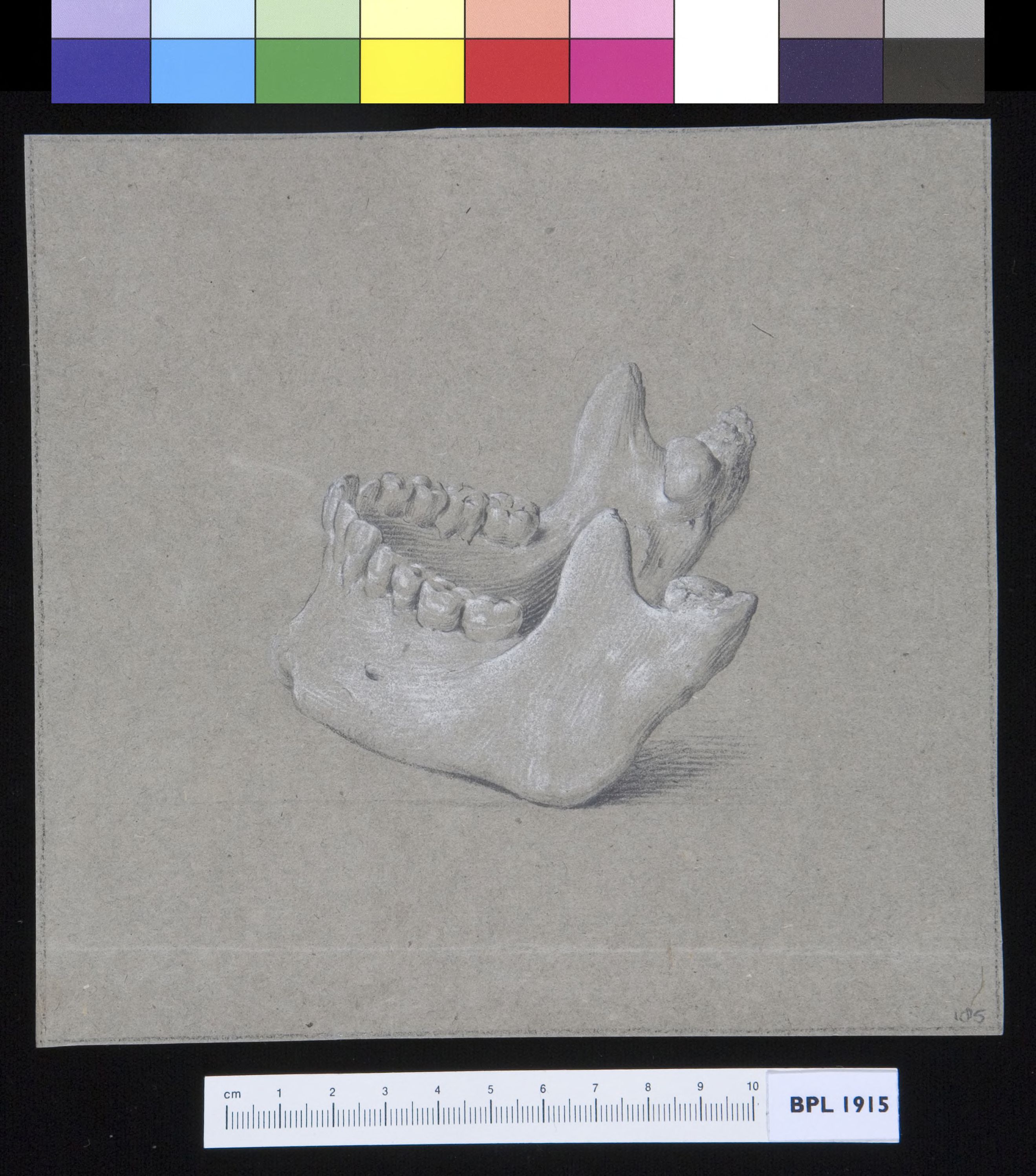 Lower jaw (manibula)