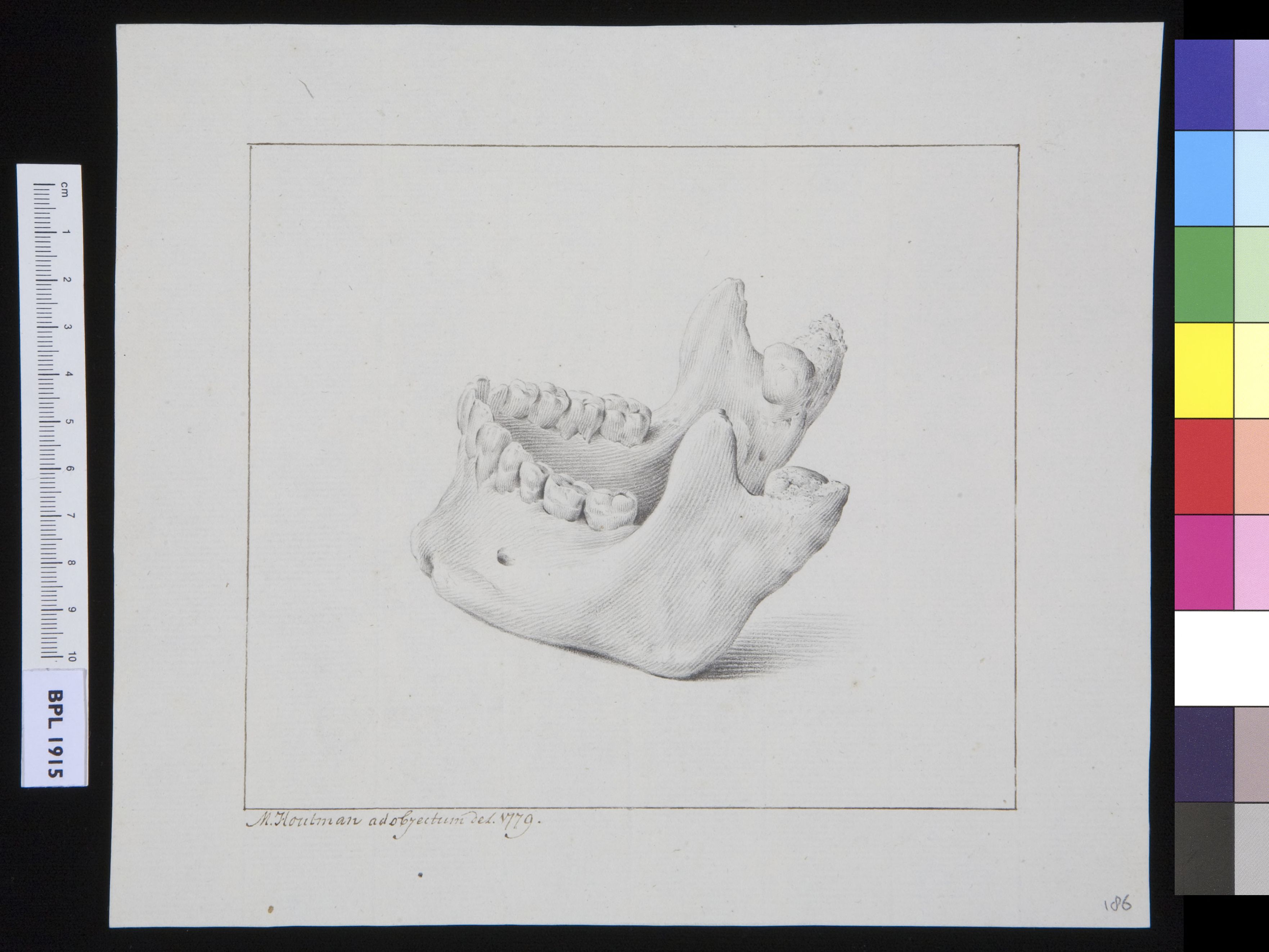 Lower jaw (manibula)