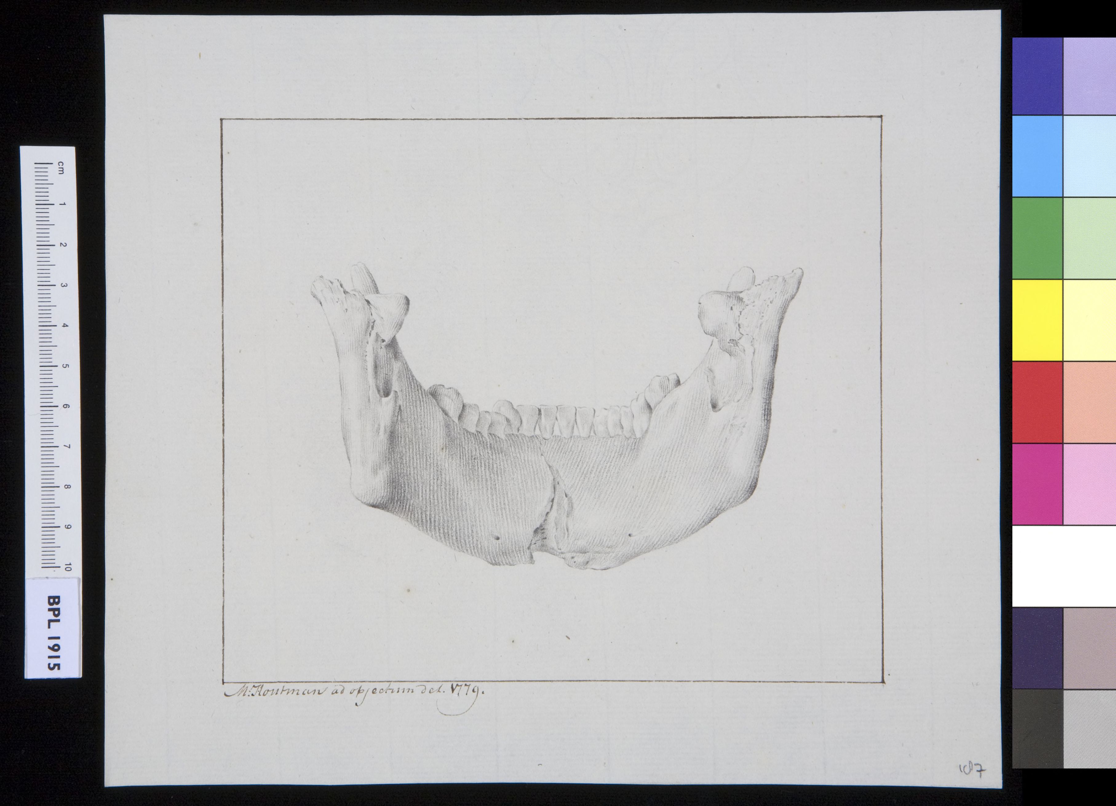 Lower jaw (manibula)