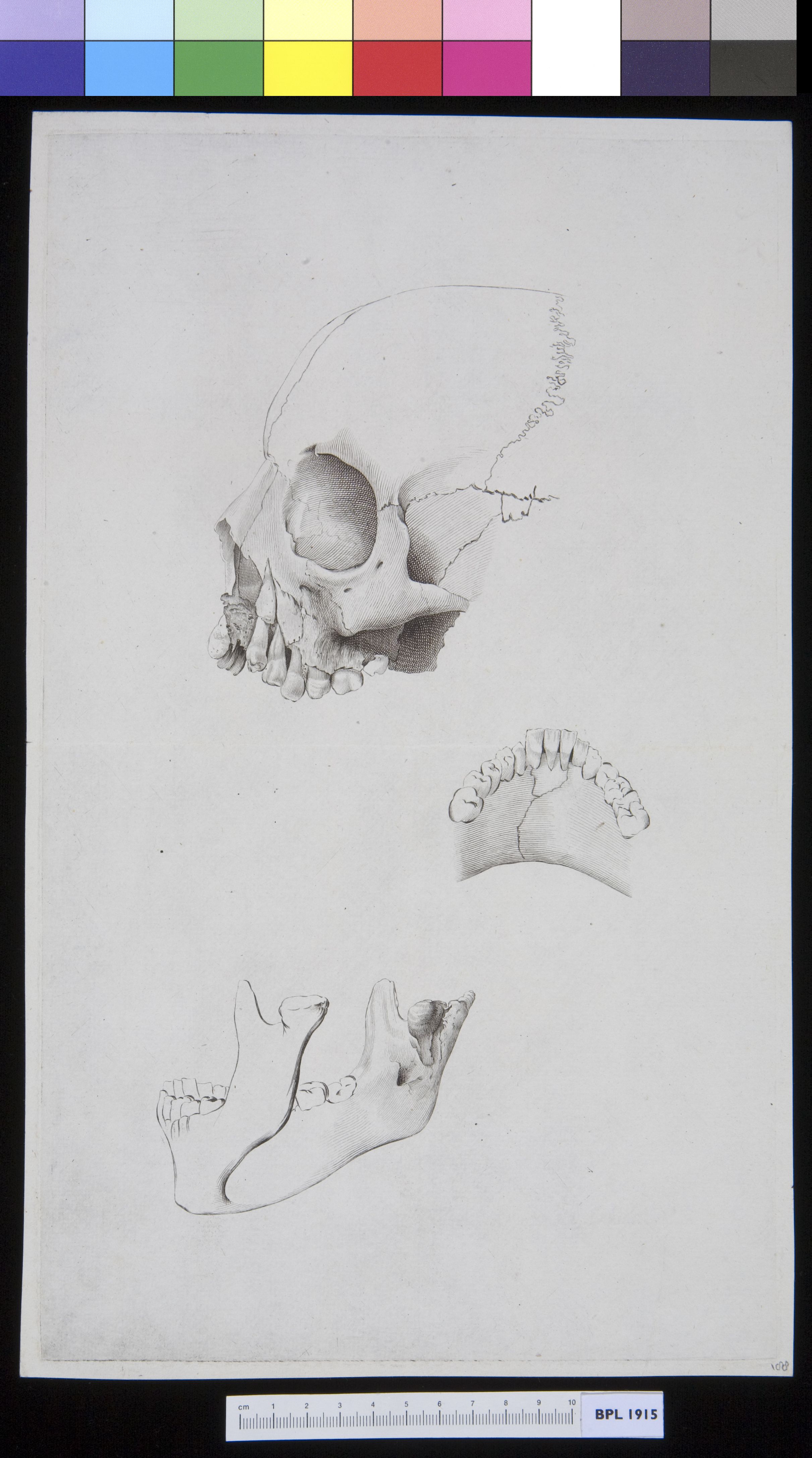 Lower jaw (manibula)