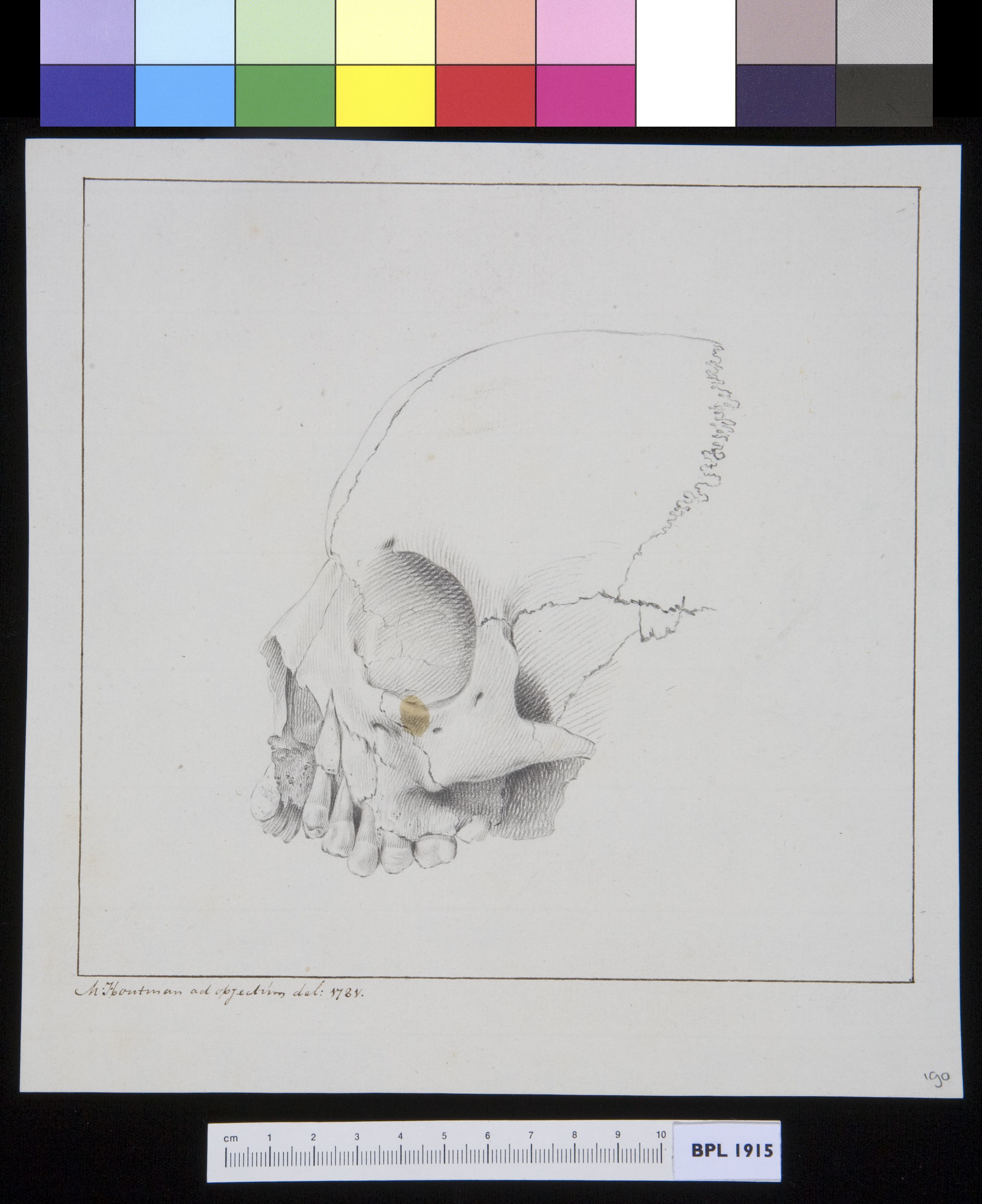 Upper jaw (maxilla)