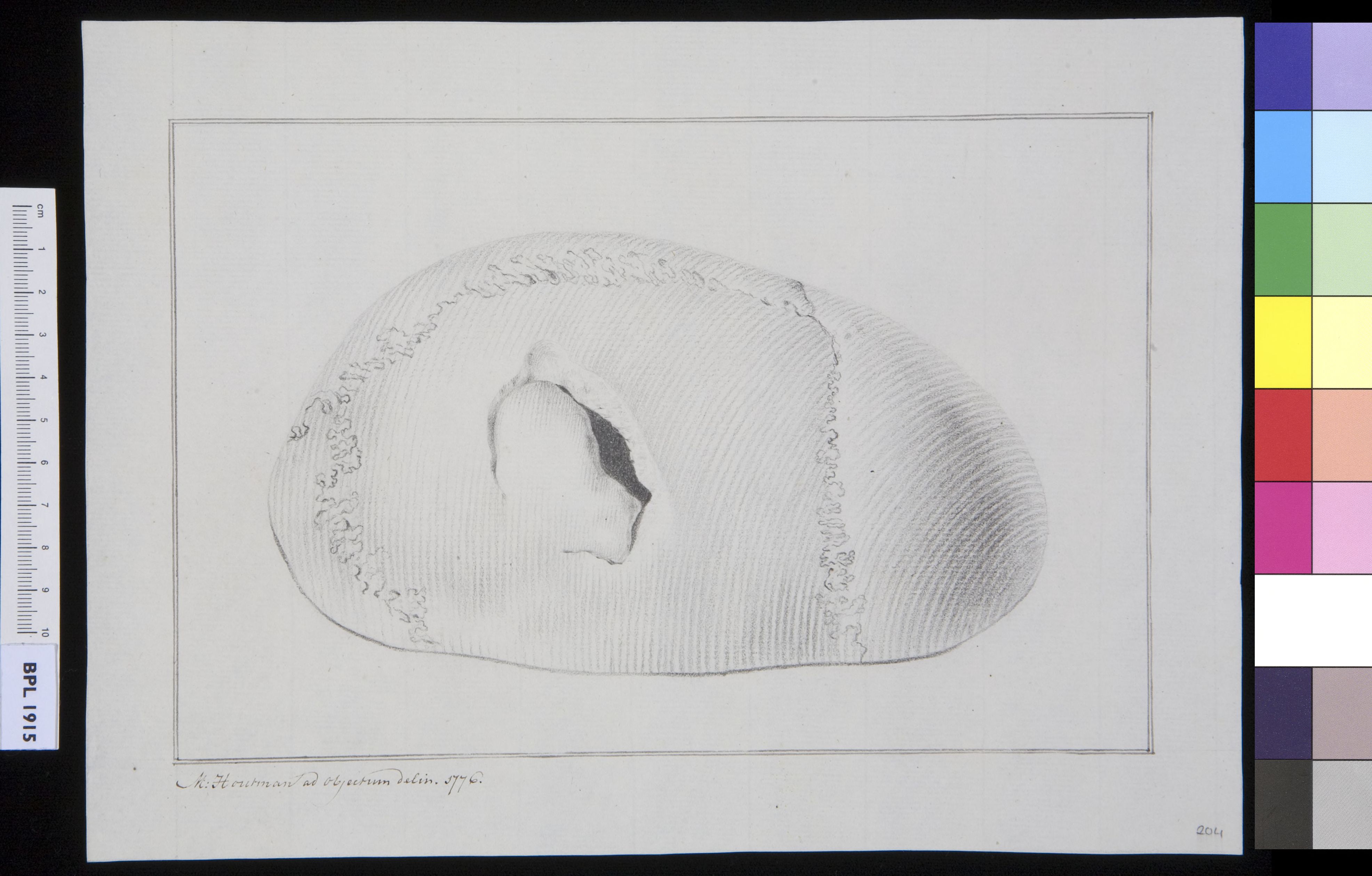 Skull, view from above, fracture