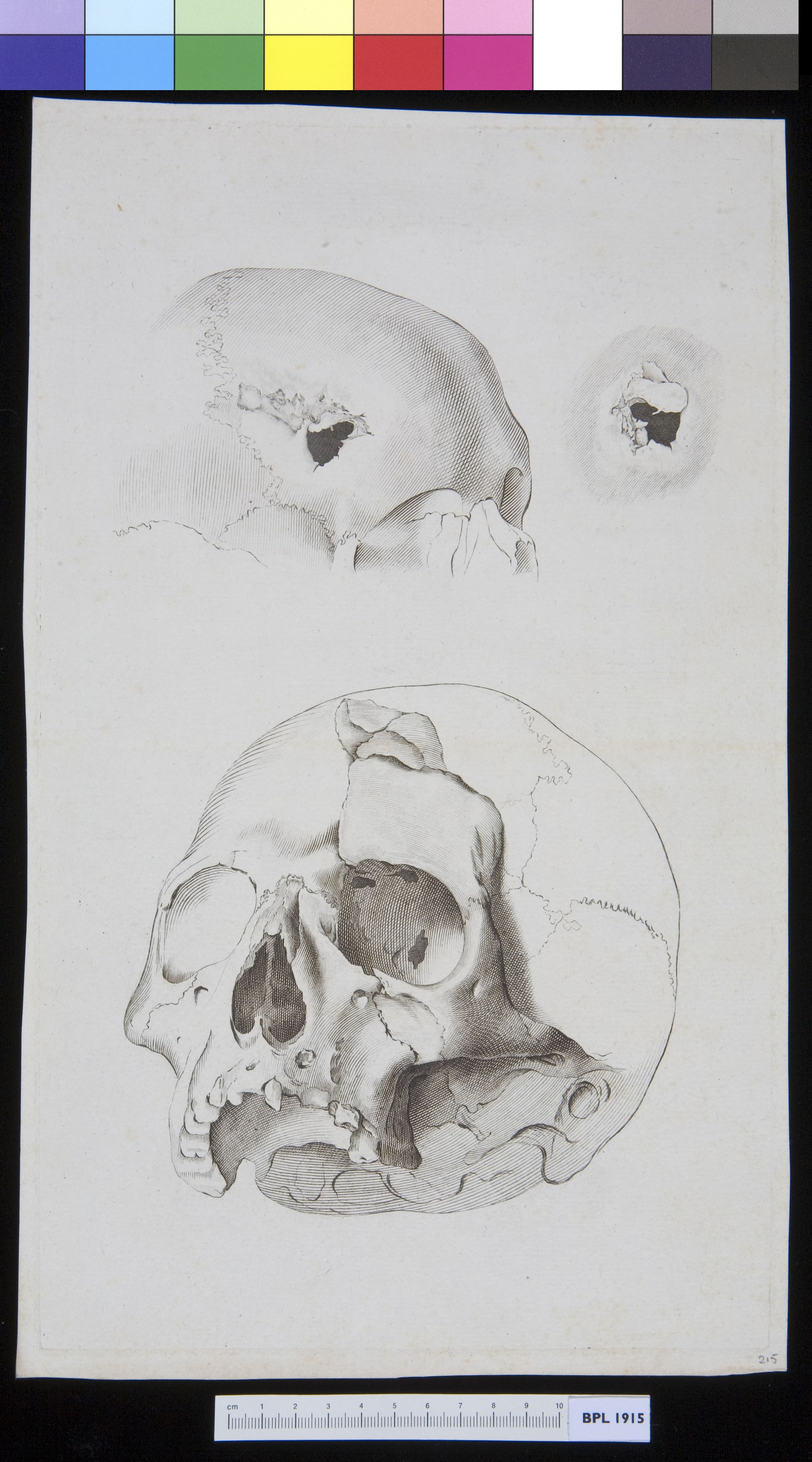 Skull with fractures, plus detail