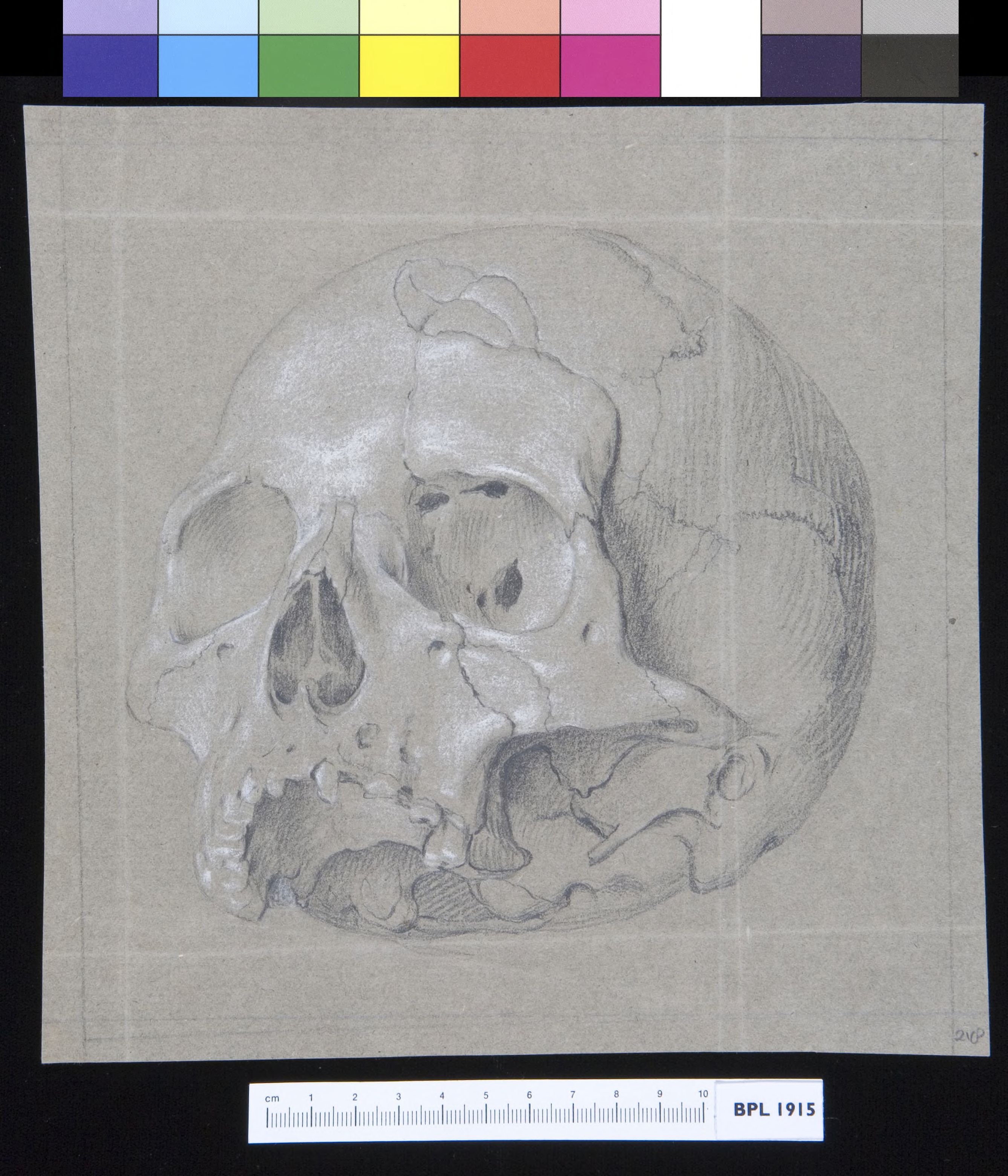 Skull with fractures