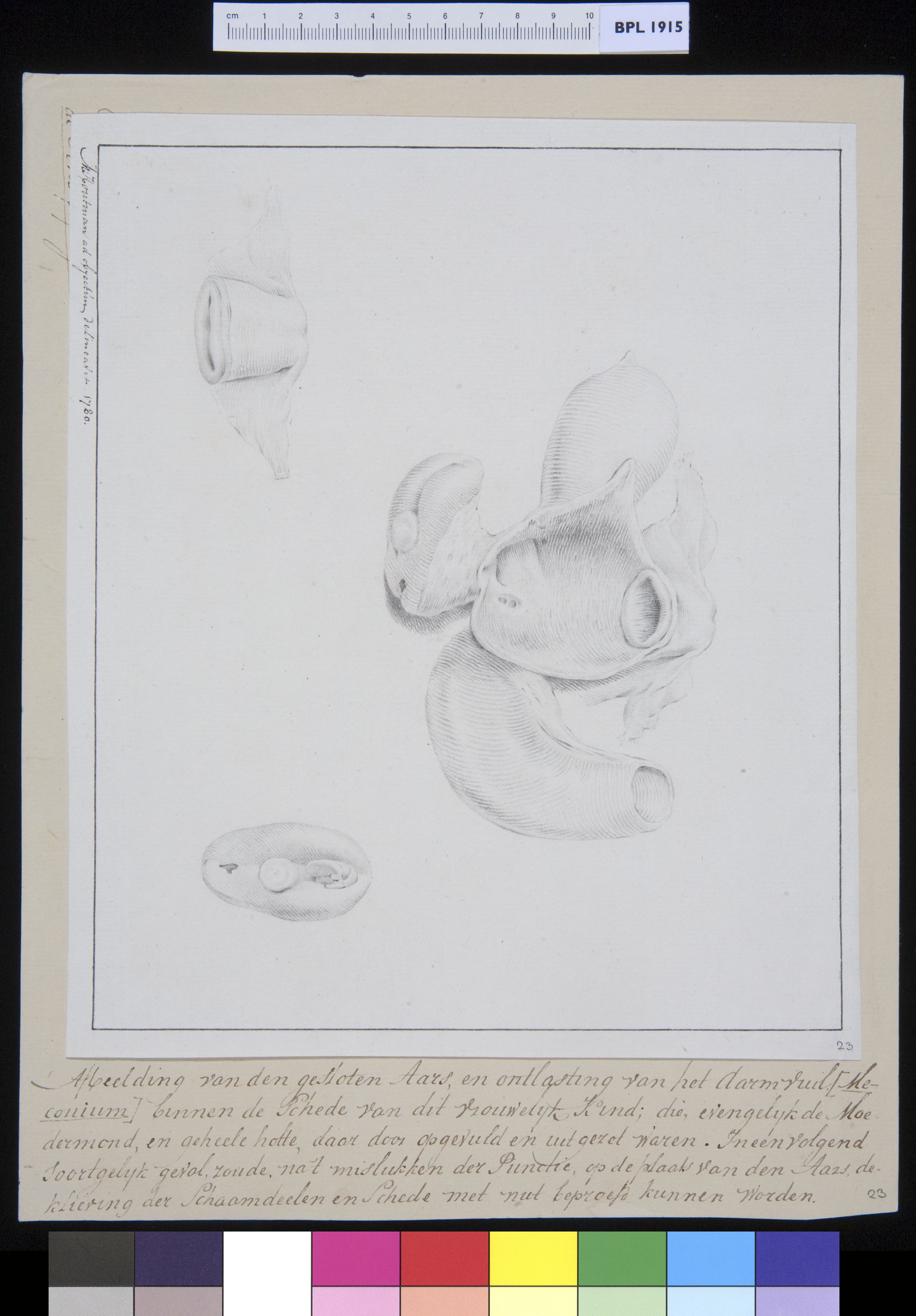 Anus and genitals (female)