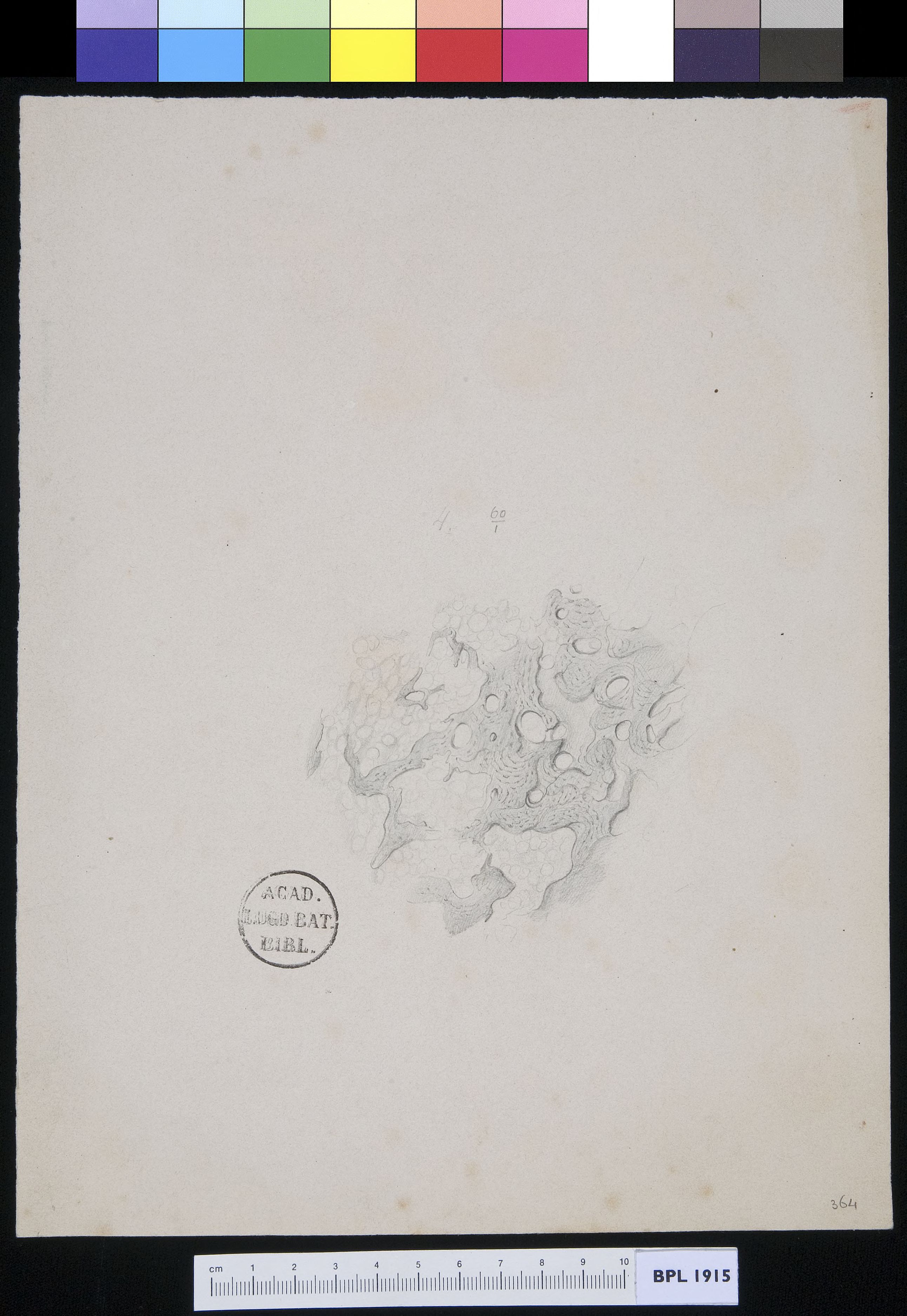 Unidentified subject (neuroma?)