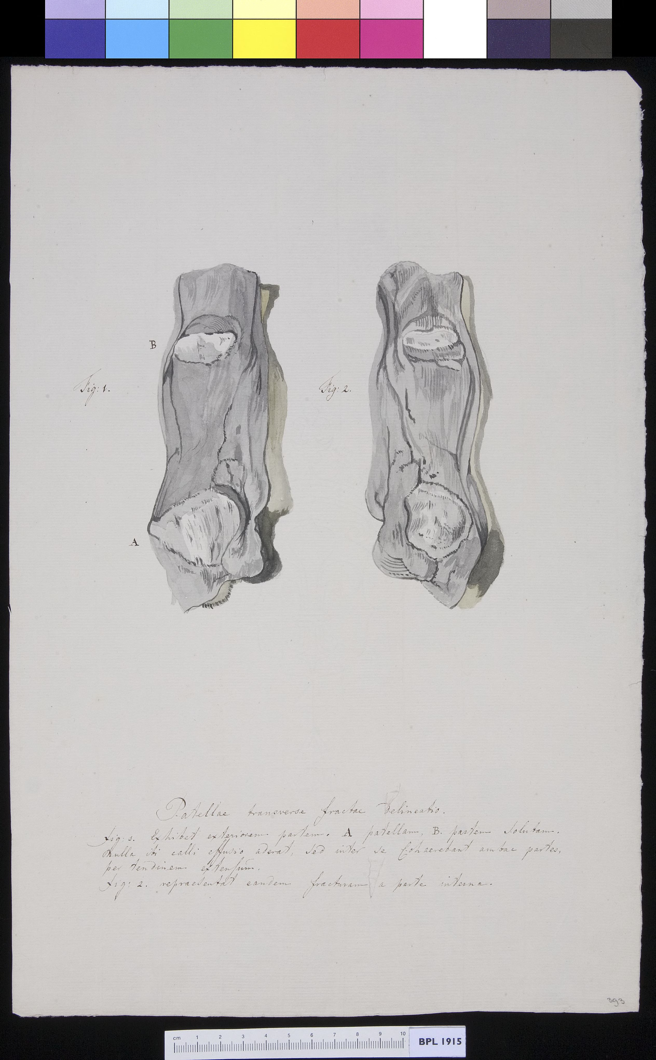 Patella