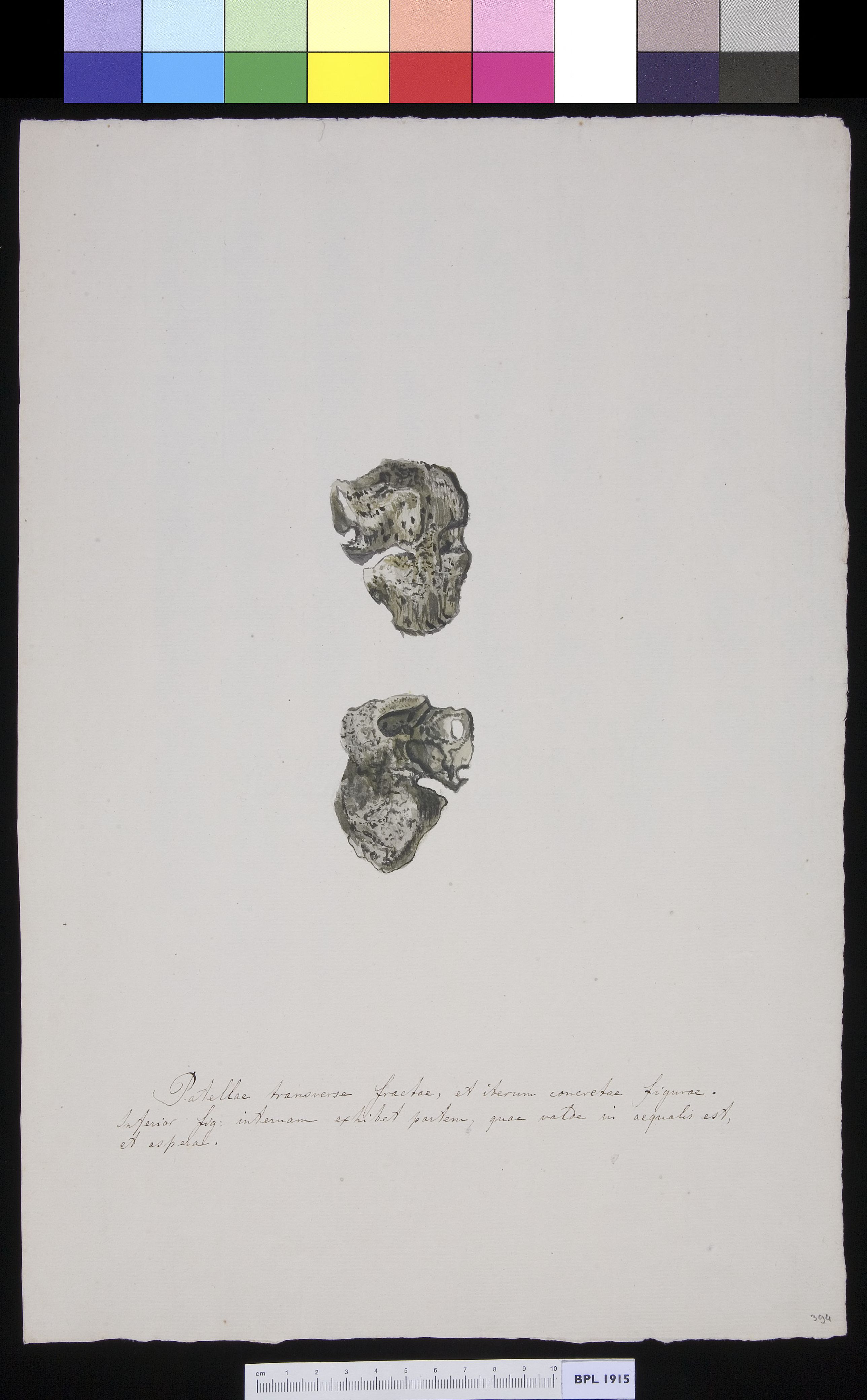 Patella
