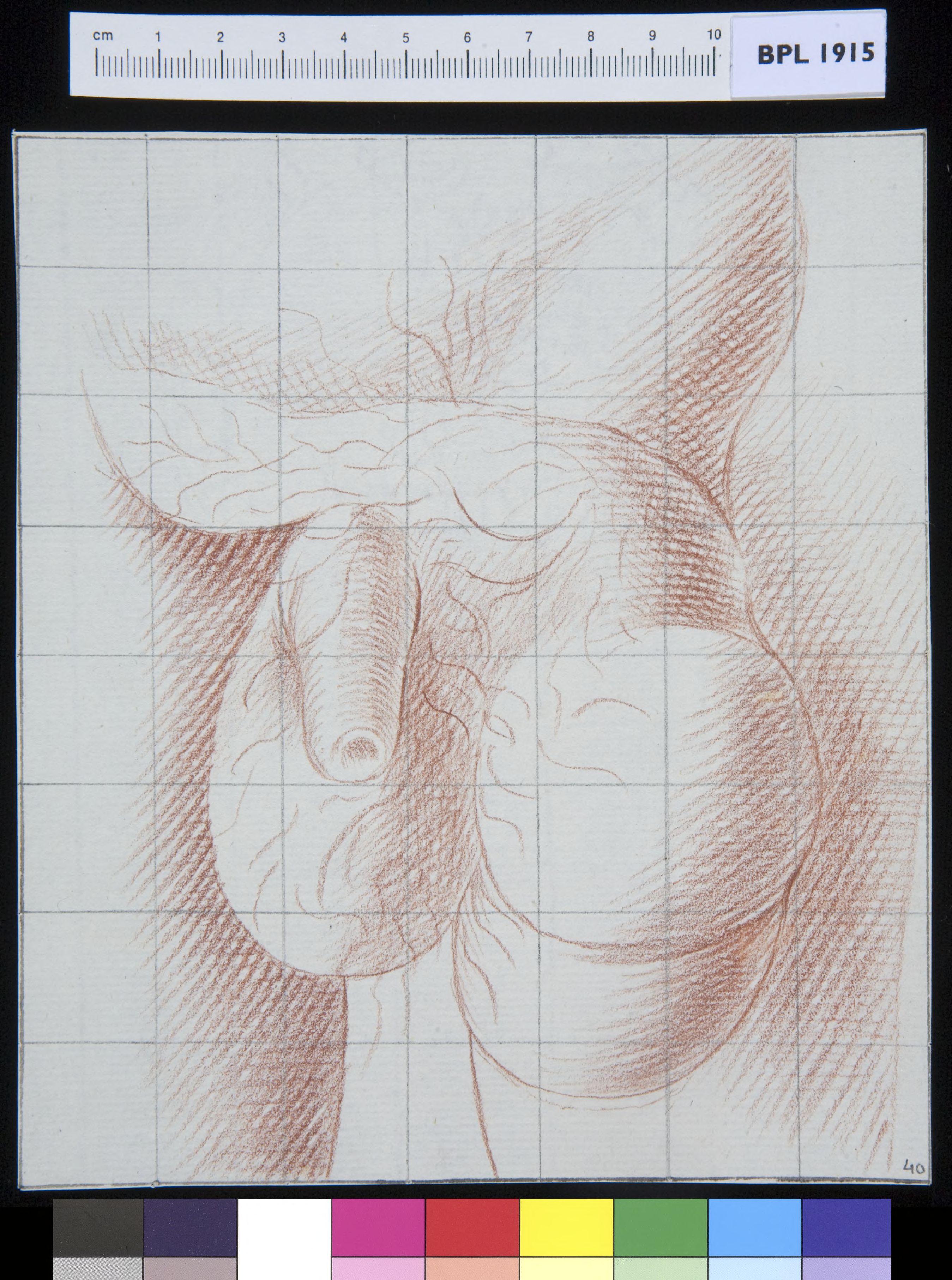 Abdominal tumor next to genitals