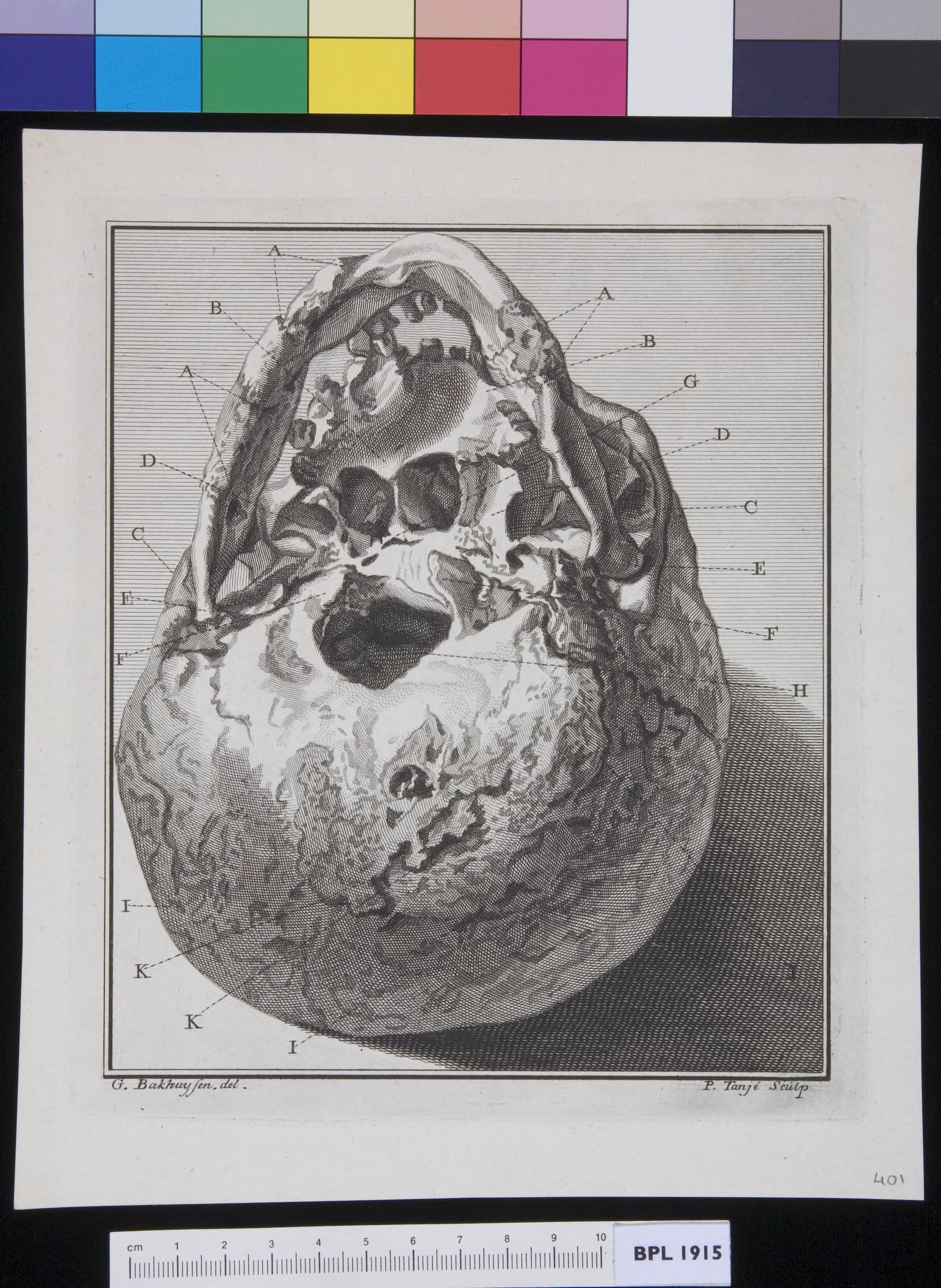Human skull, fractures, lying upside down