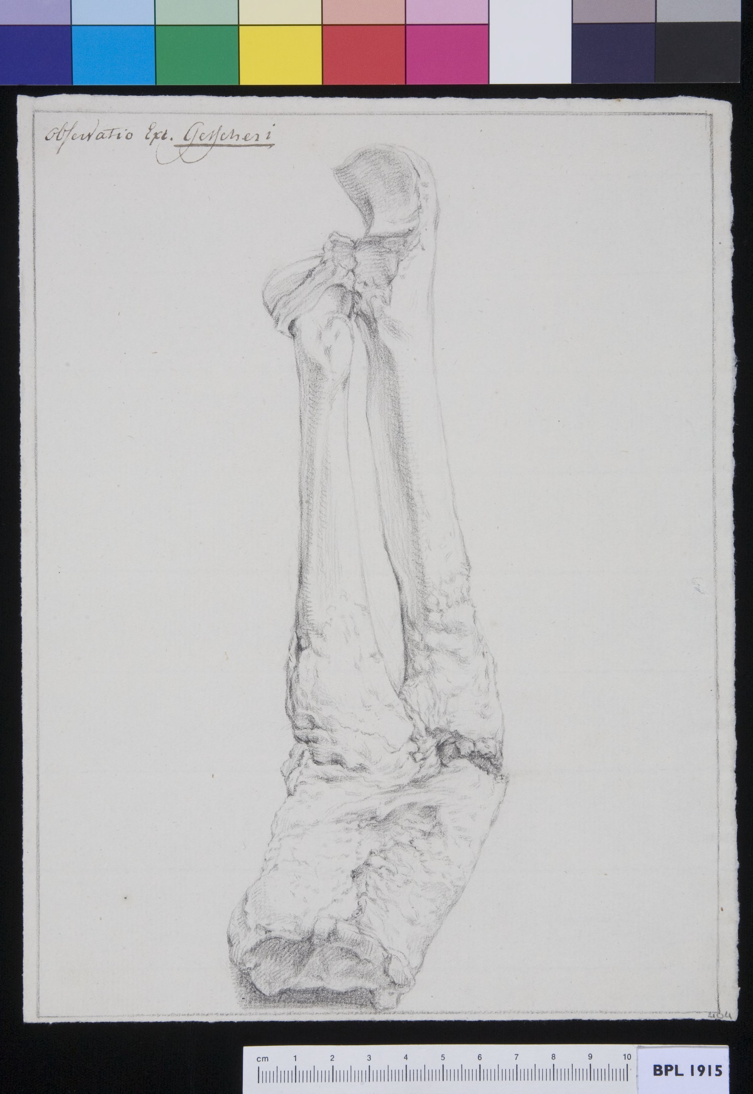 Tibia and fibula