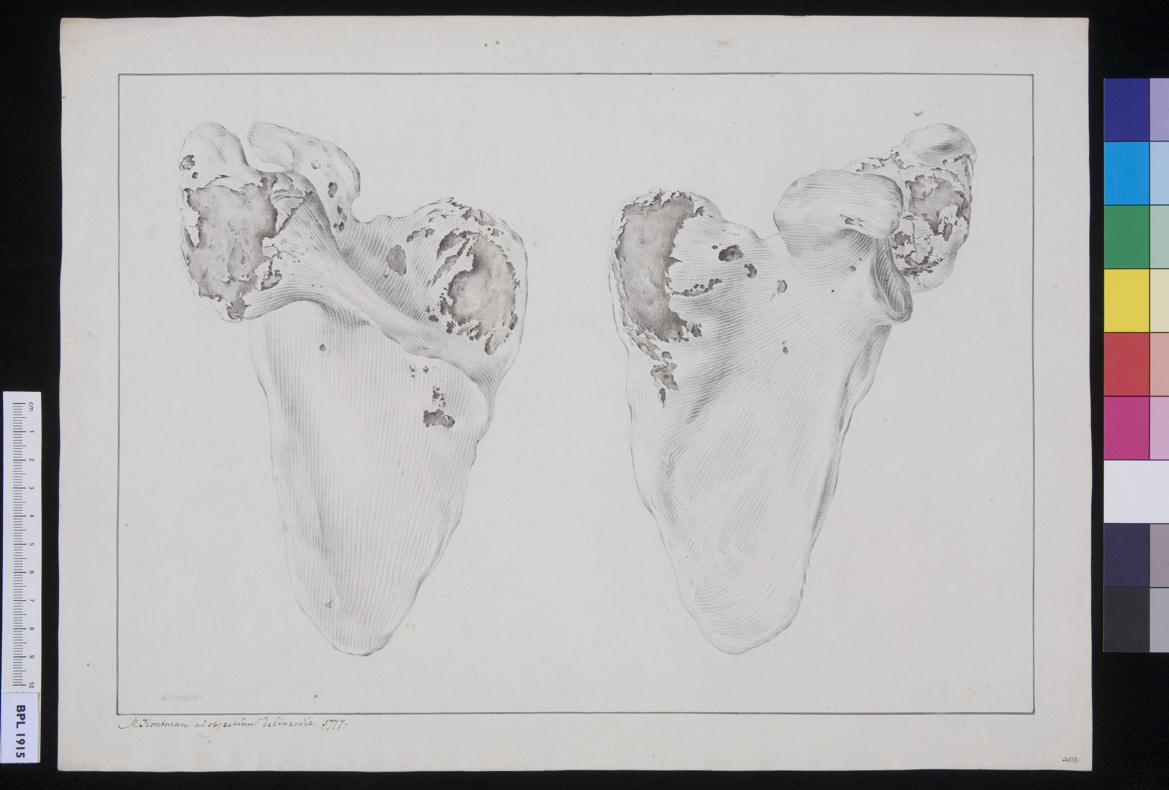 Scapula
