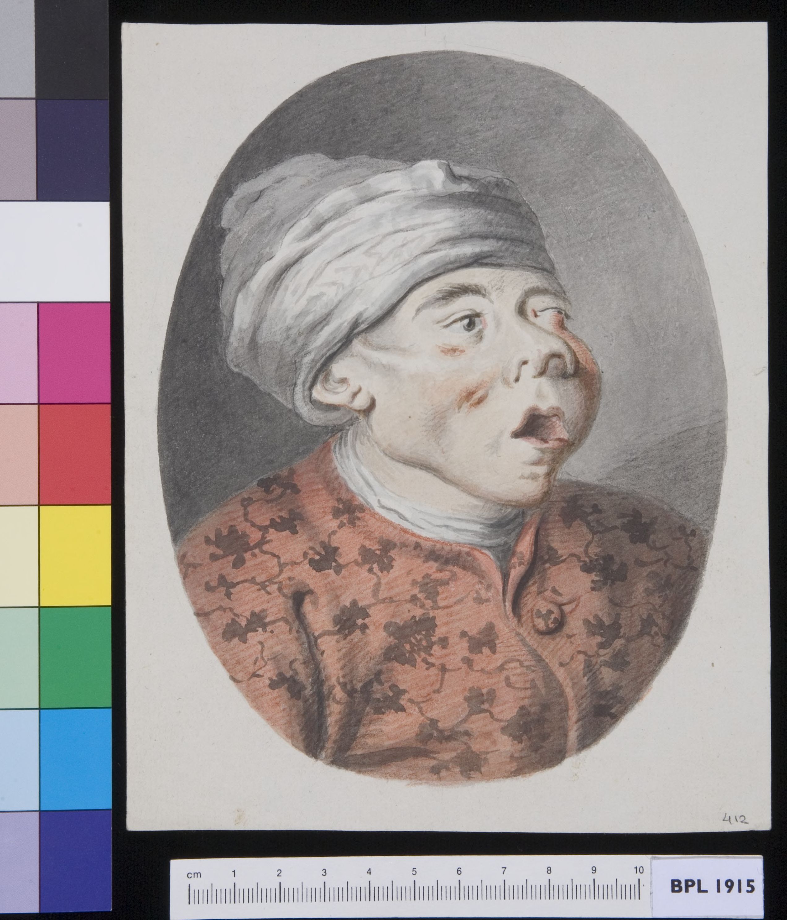 Man with an infection in his face