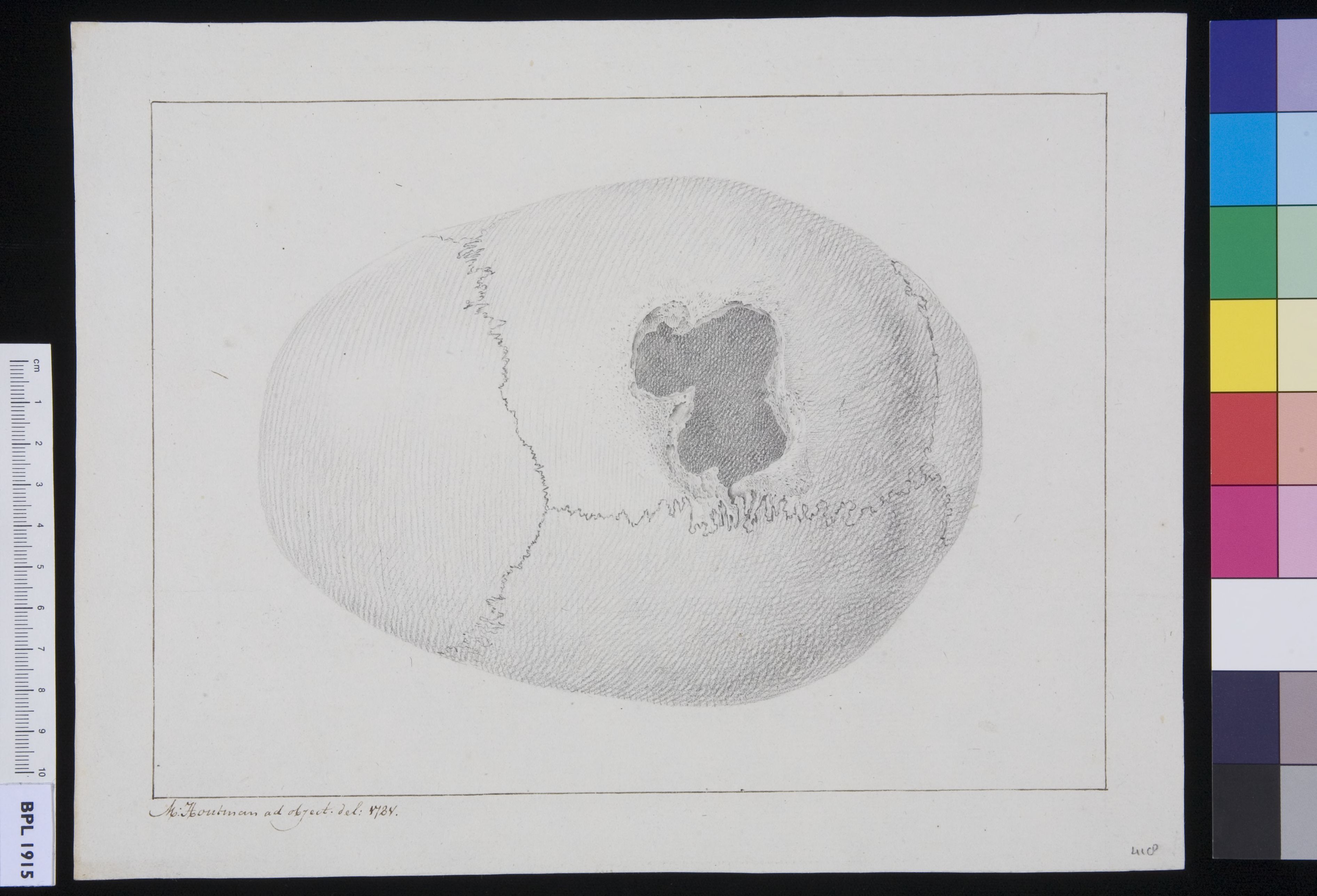 Calvaria (skull)
