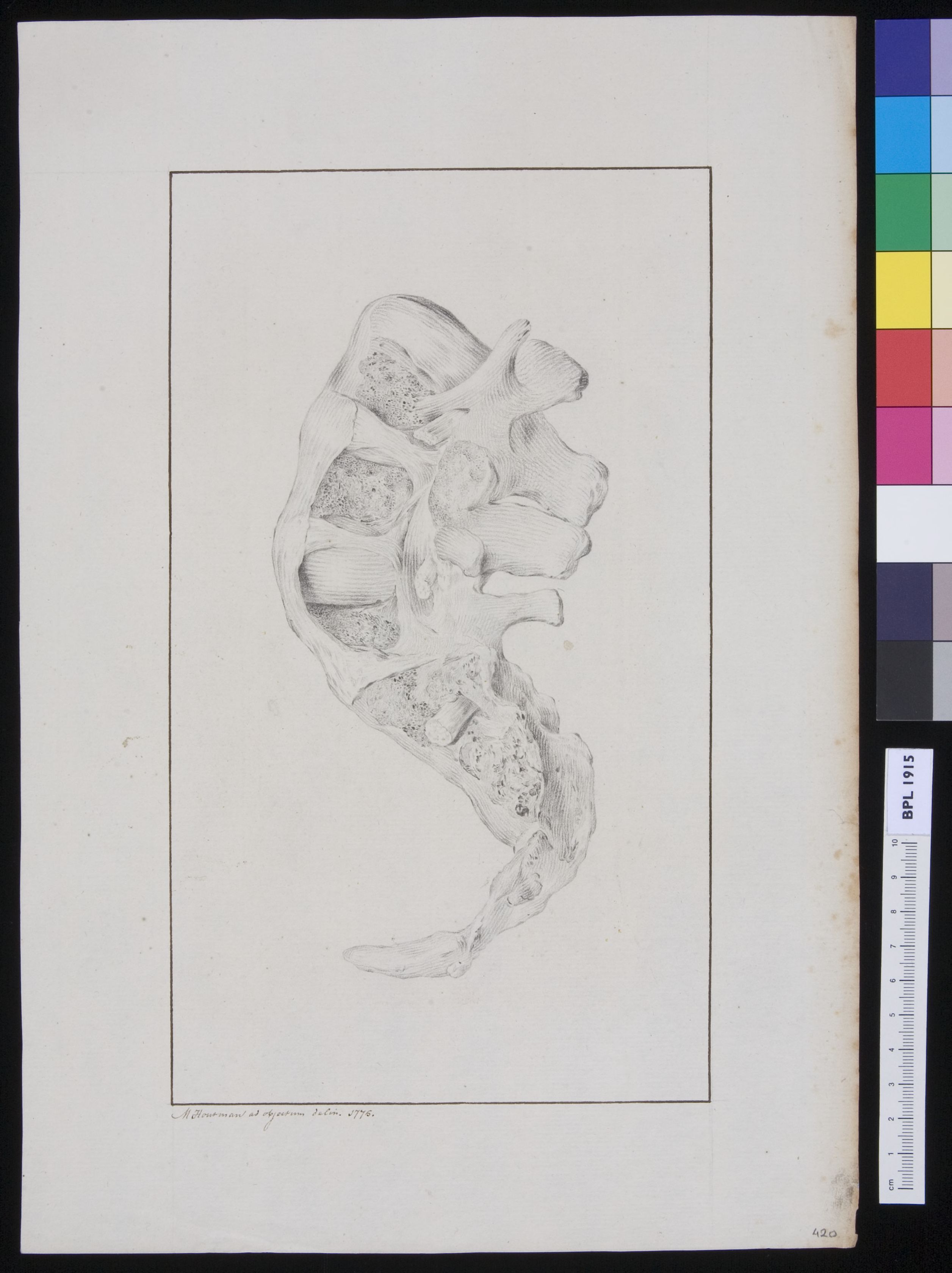 Torsioned vertebrae