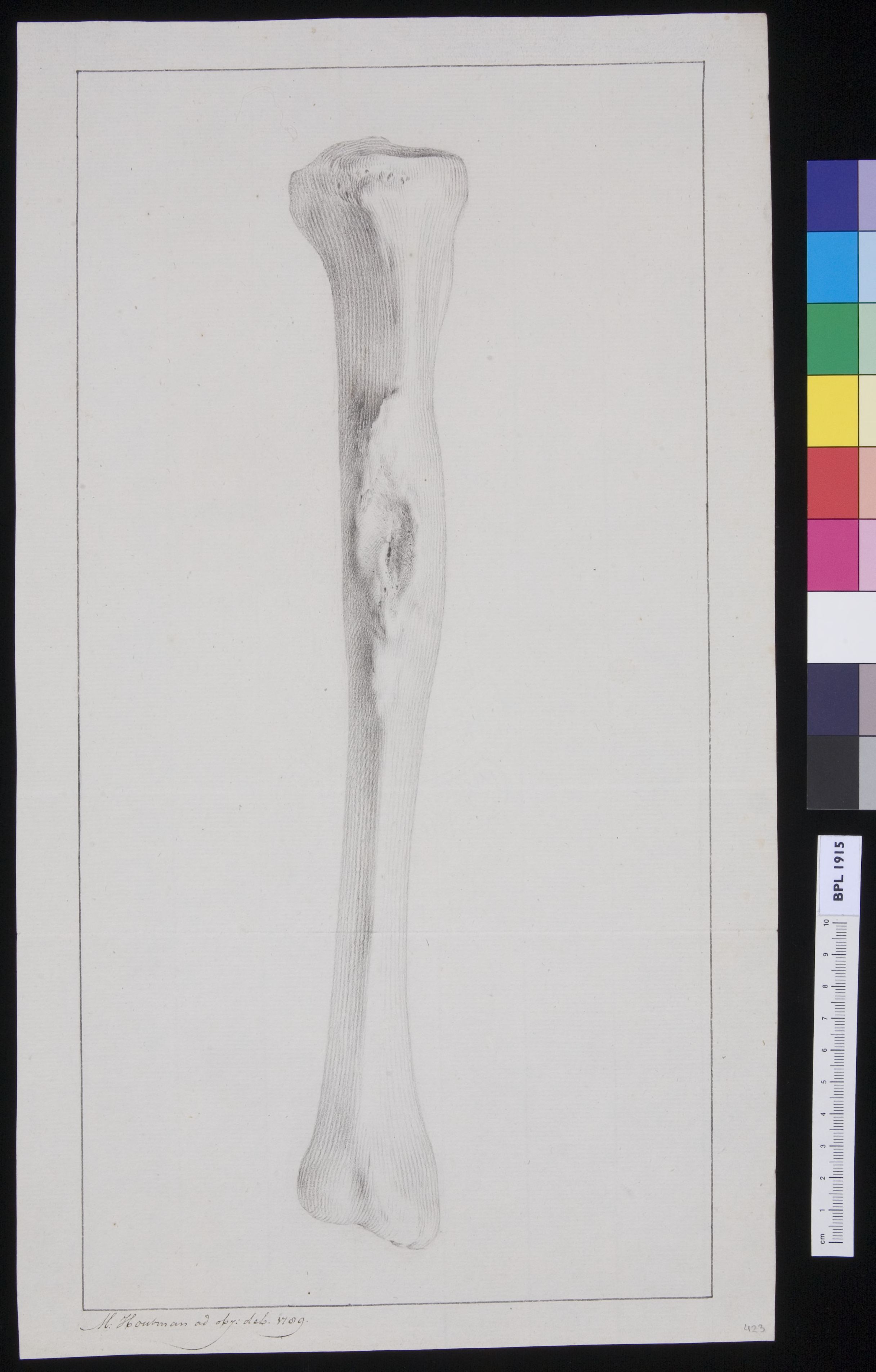 Tibia