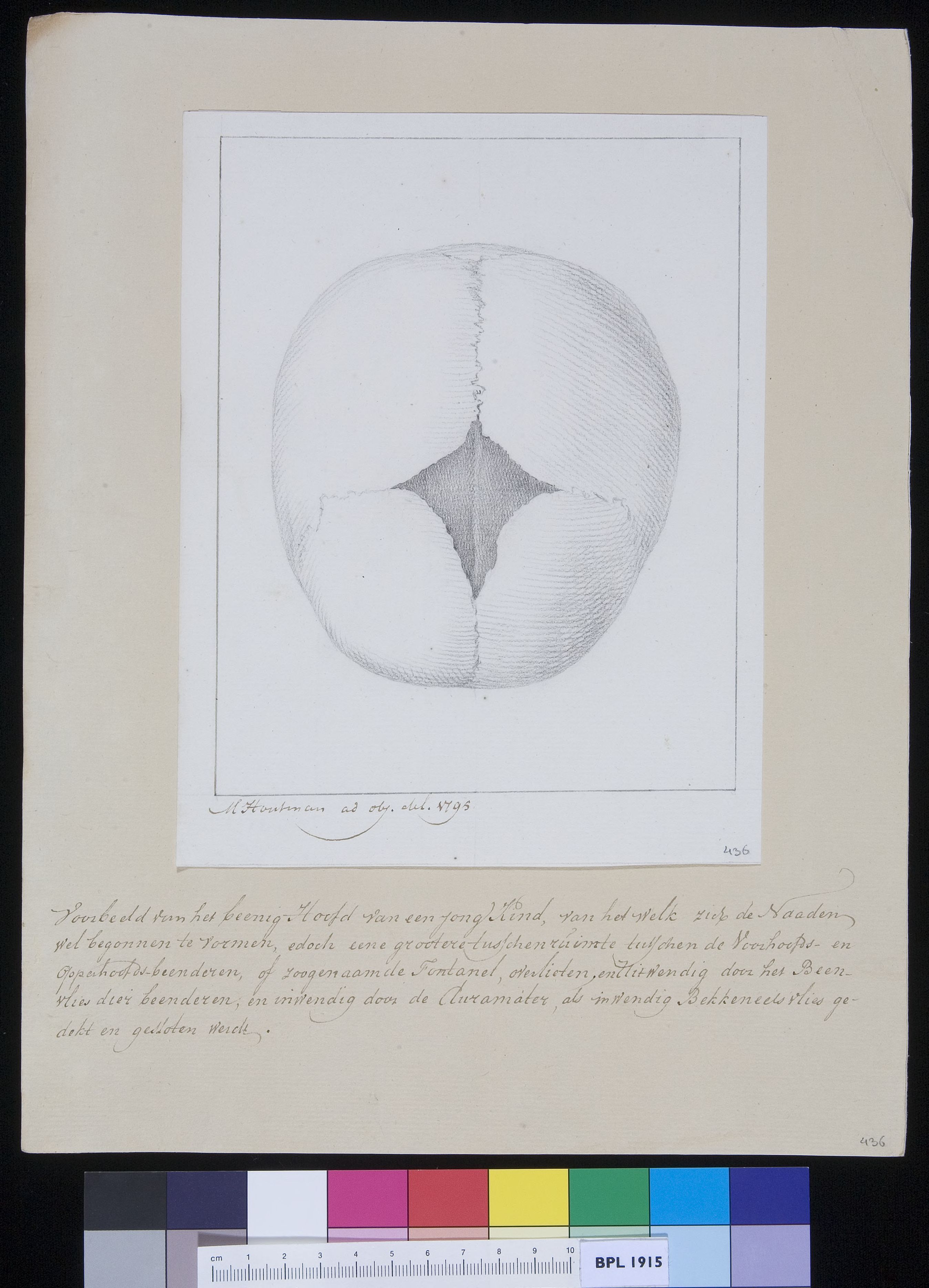 Calvaria (skull)