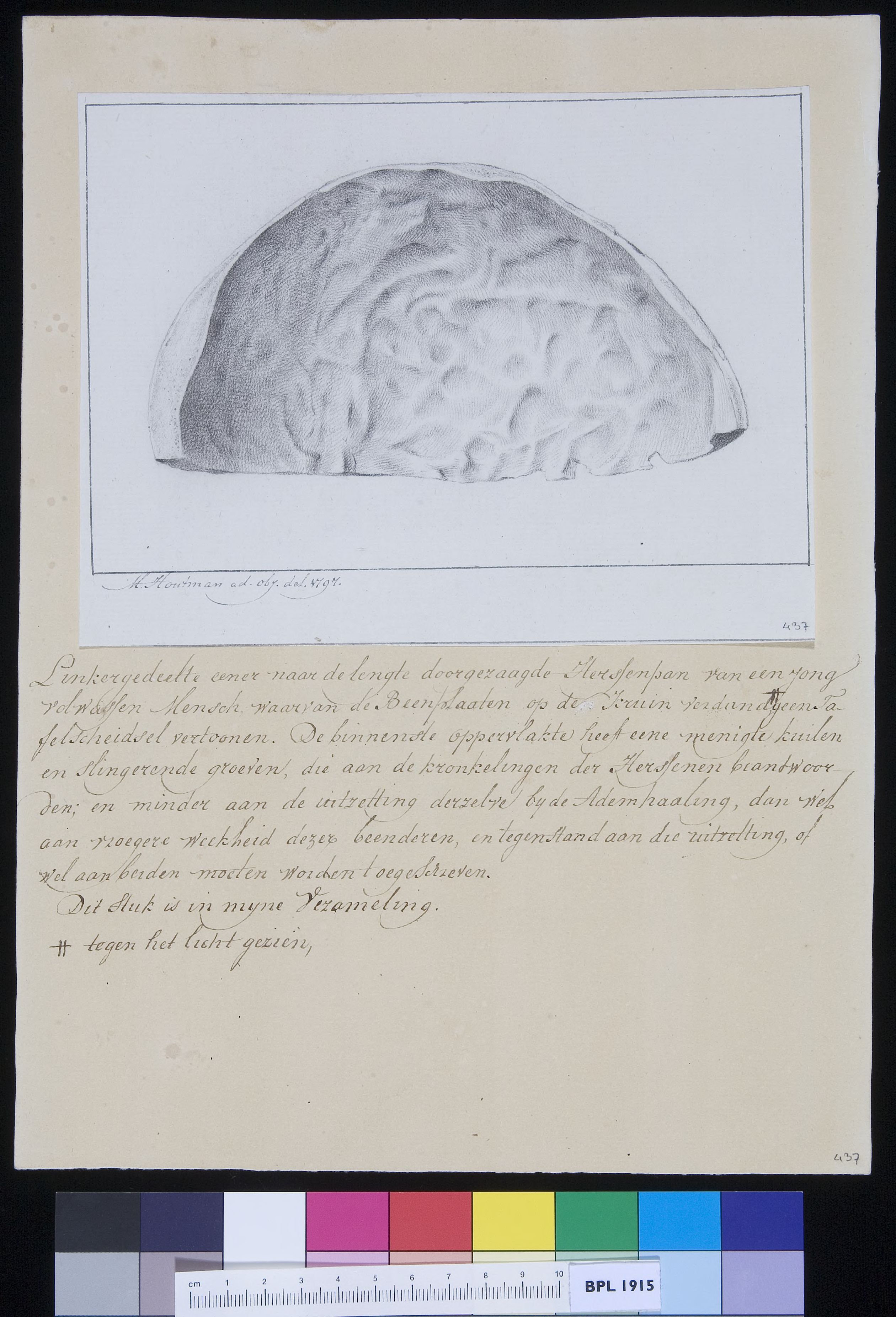 Calvaria (skull)