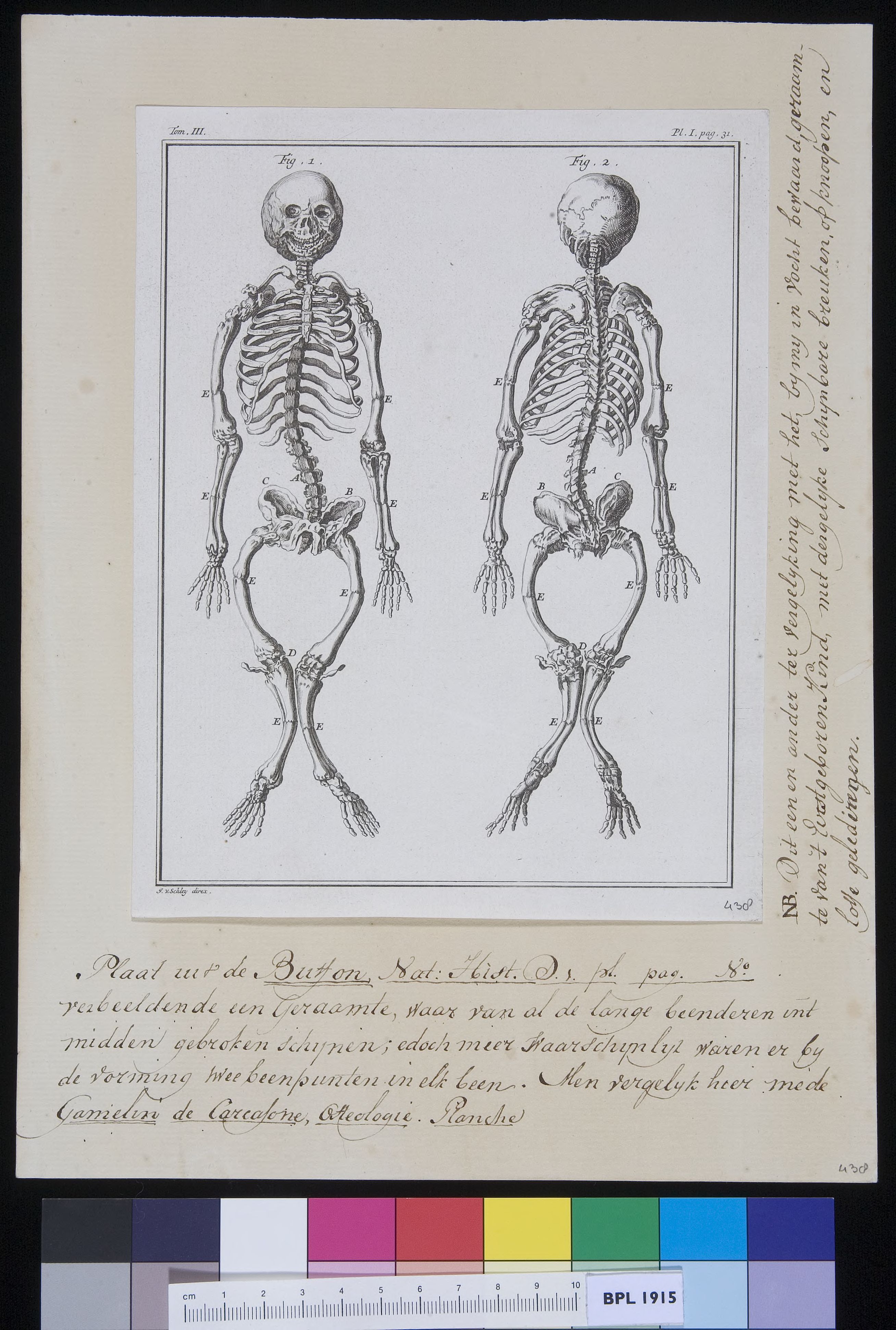 Skeleton with broken joints