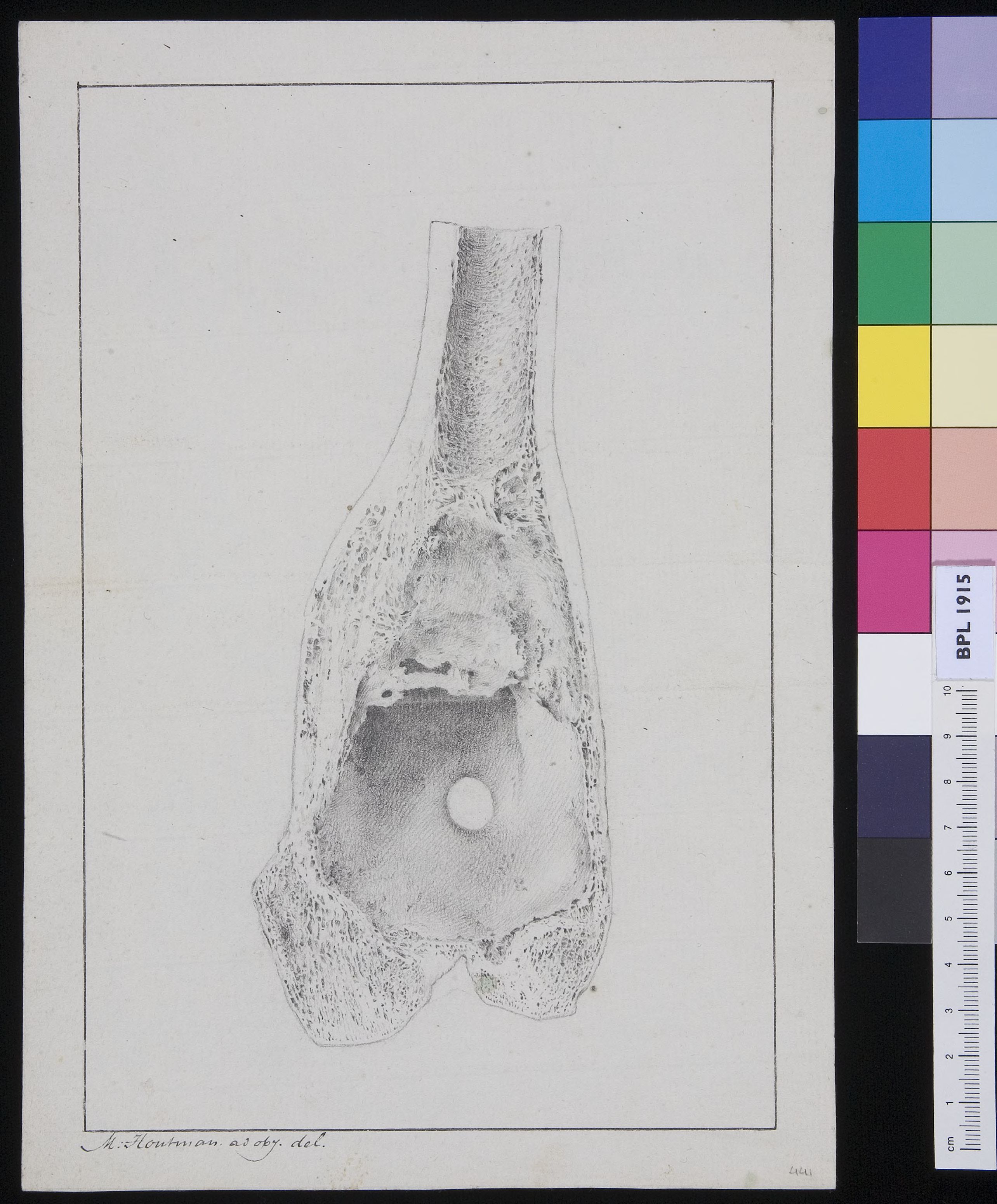 Bone from either an arm or leg