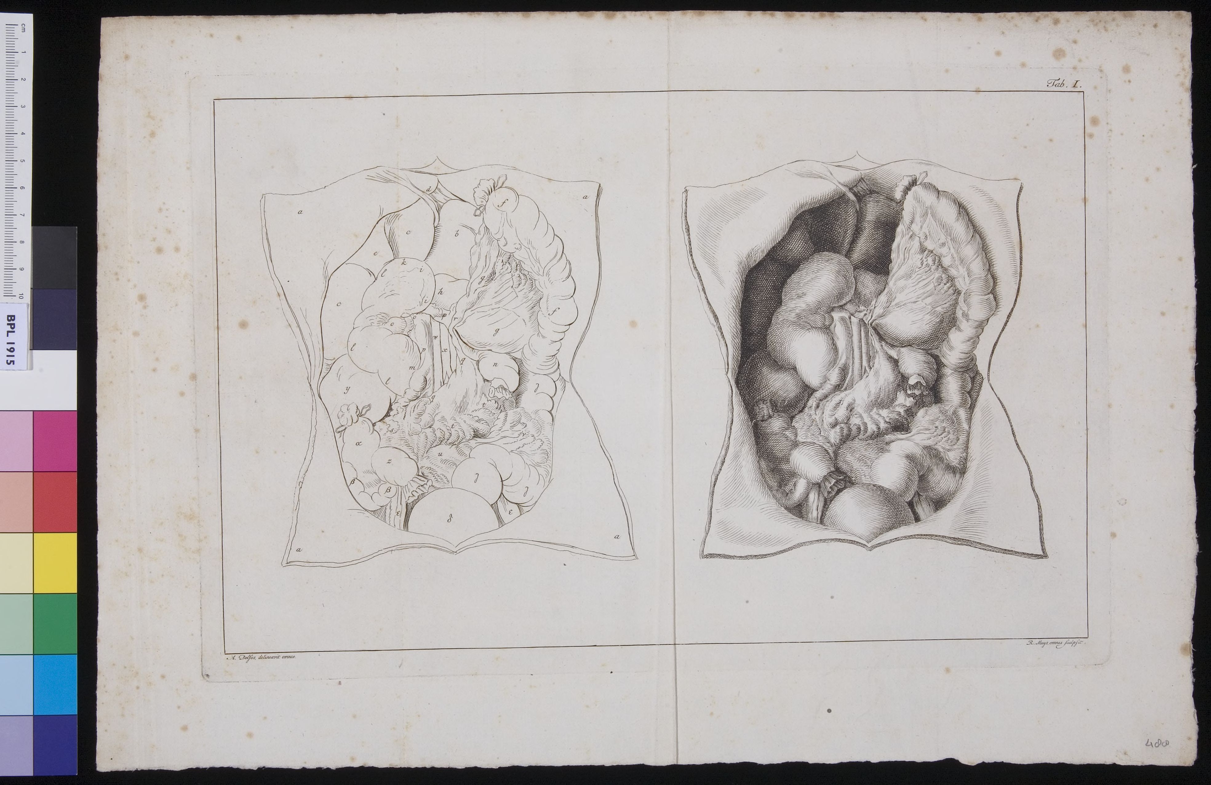 Opened abdomen, showing the duodenum