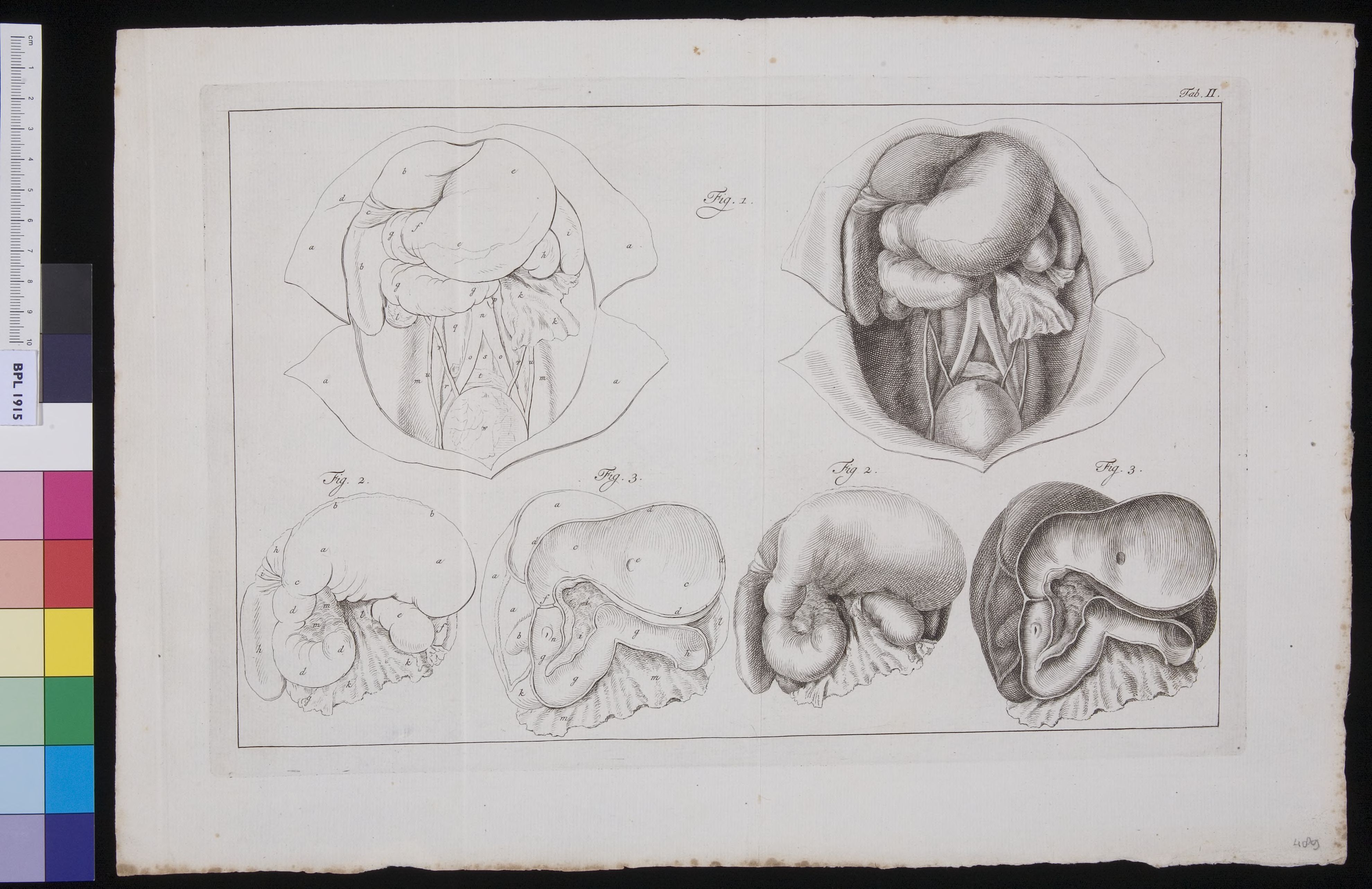 Organs in the abdomen