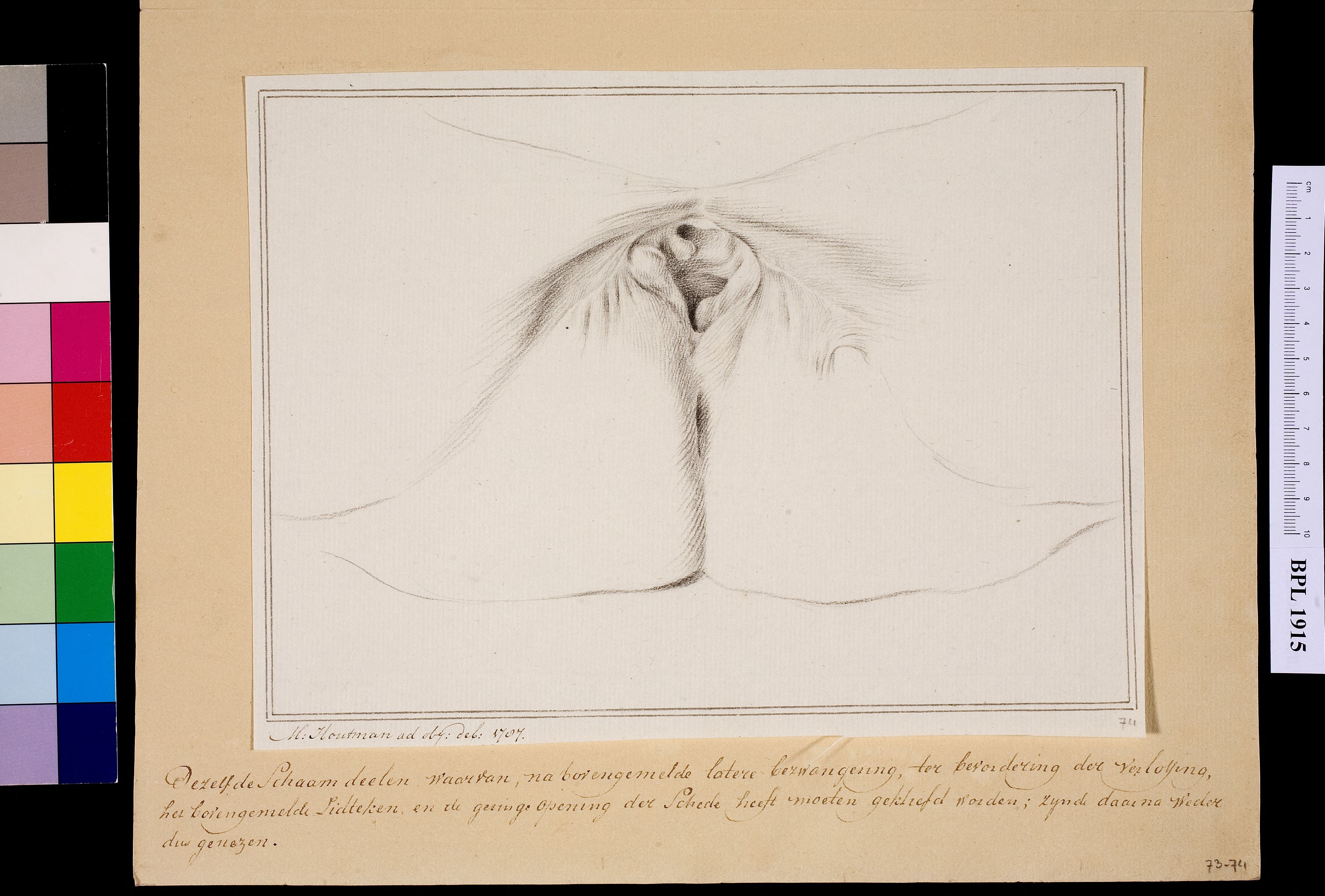 Female genitals