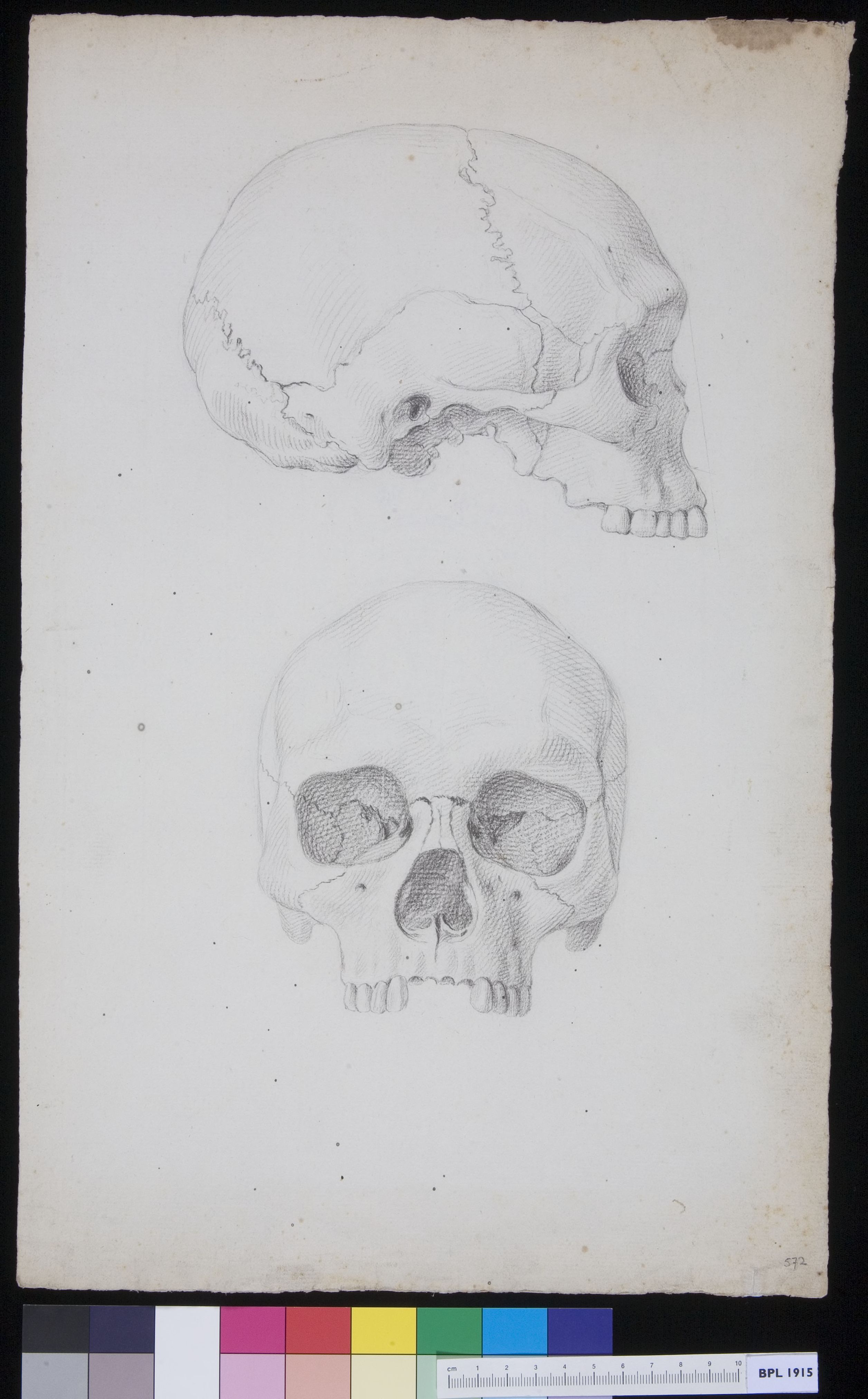 Human skull, two views