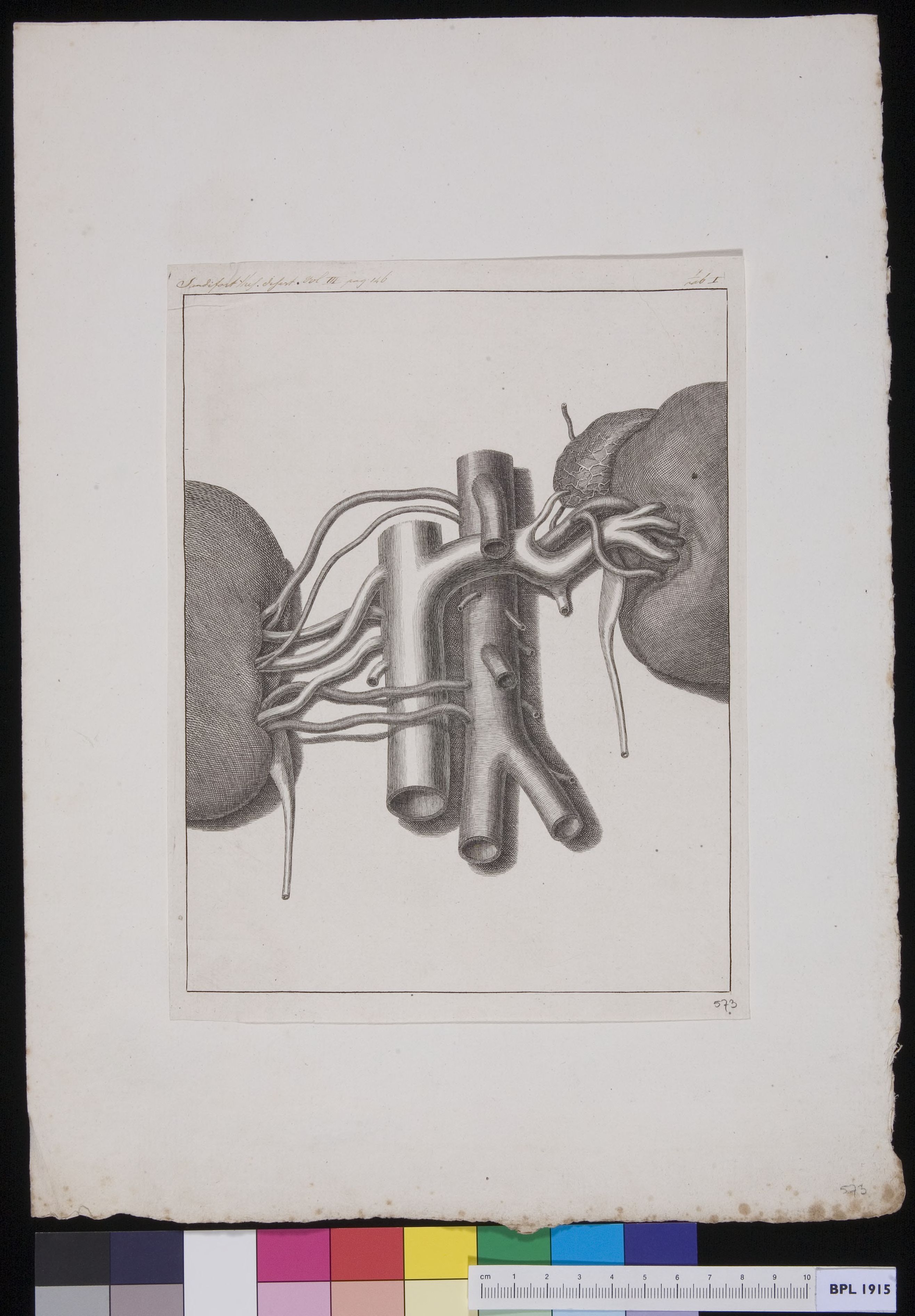 Kidneys and arteries