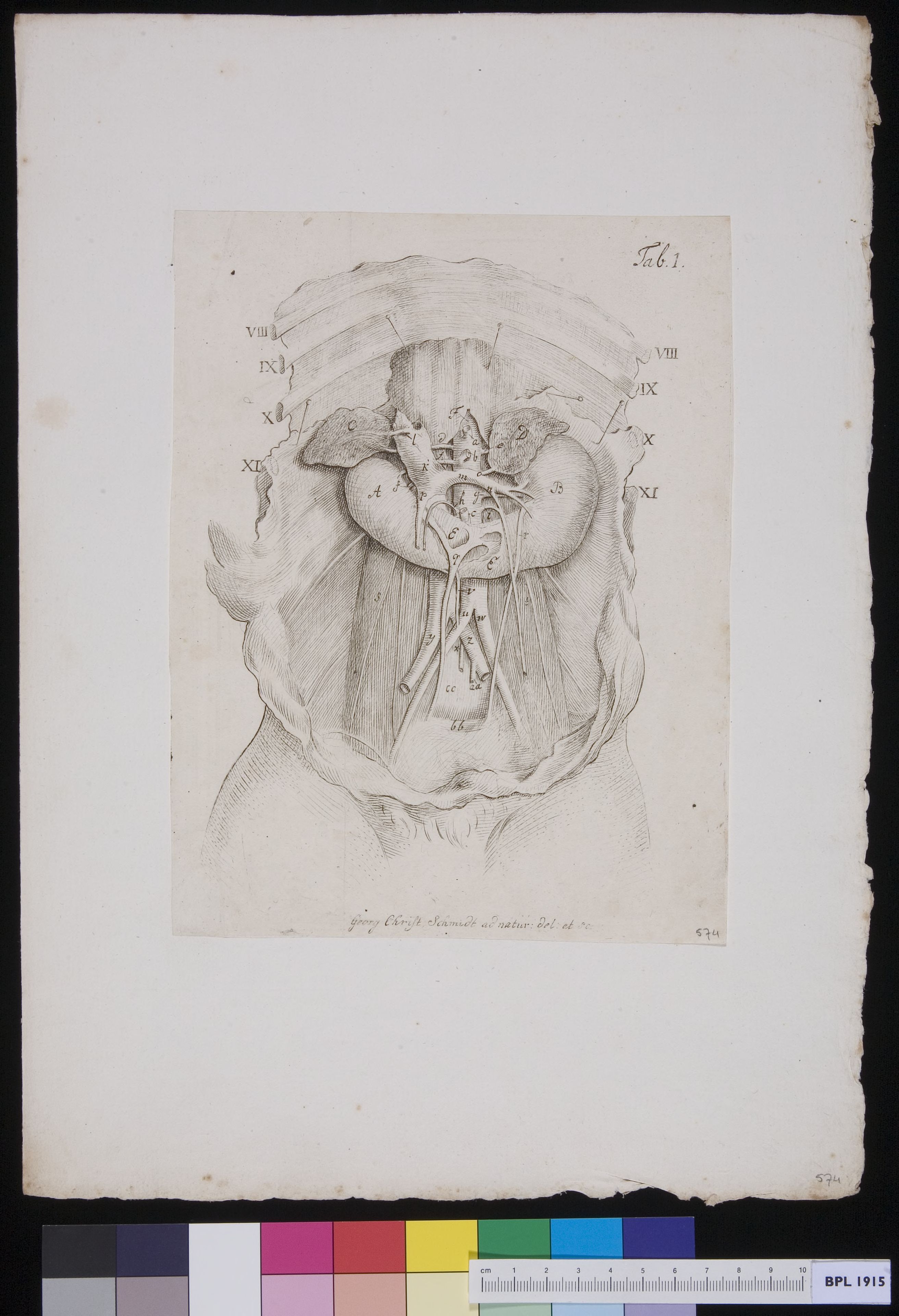 Opened abdomen with location stomach and arteries