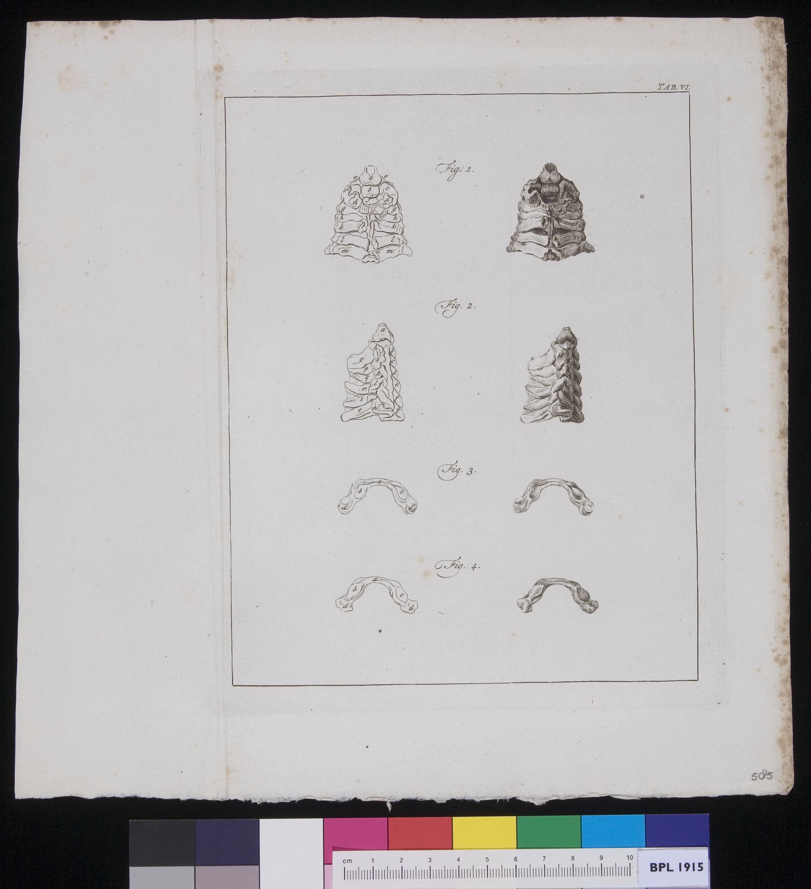 Vertebrae