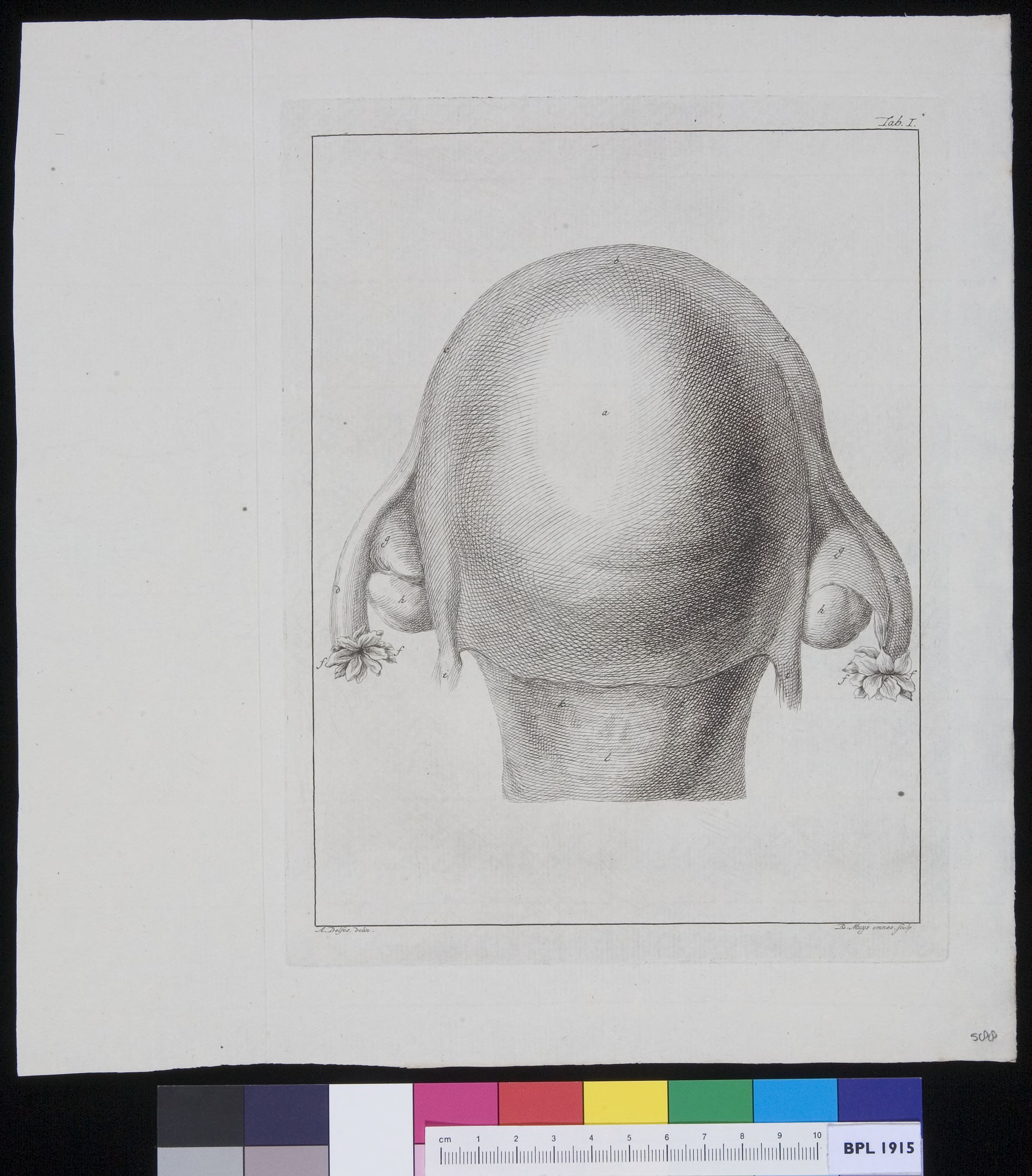 The womb (outer image)