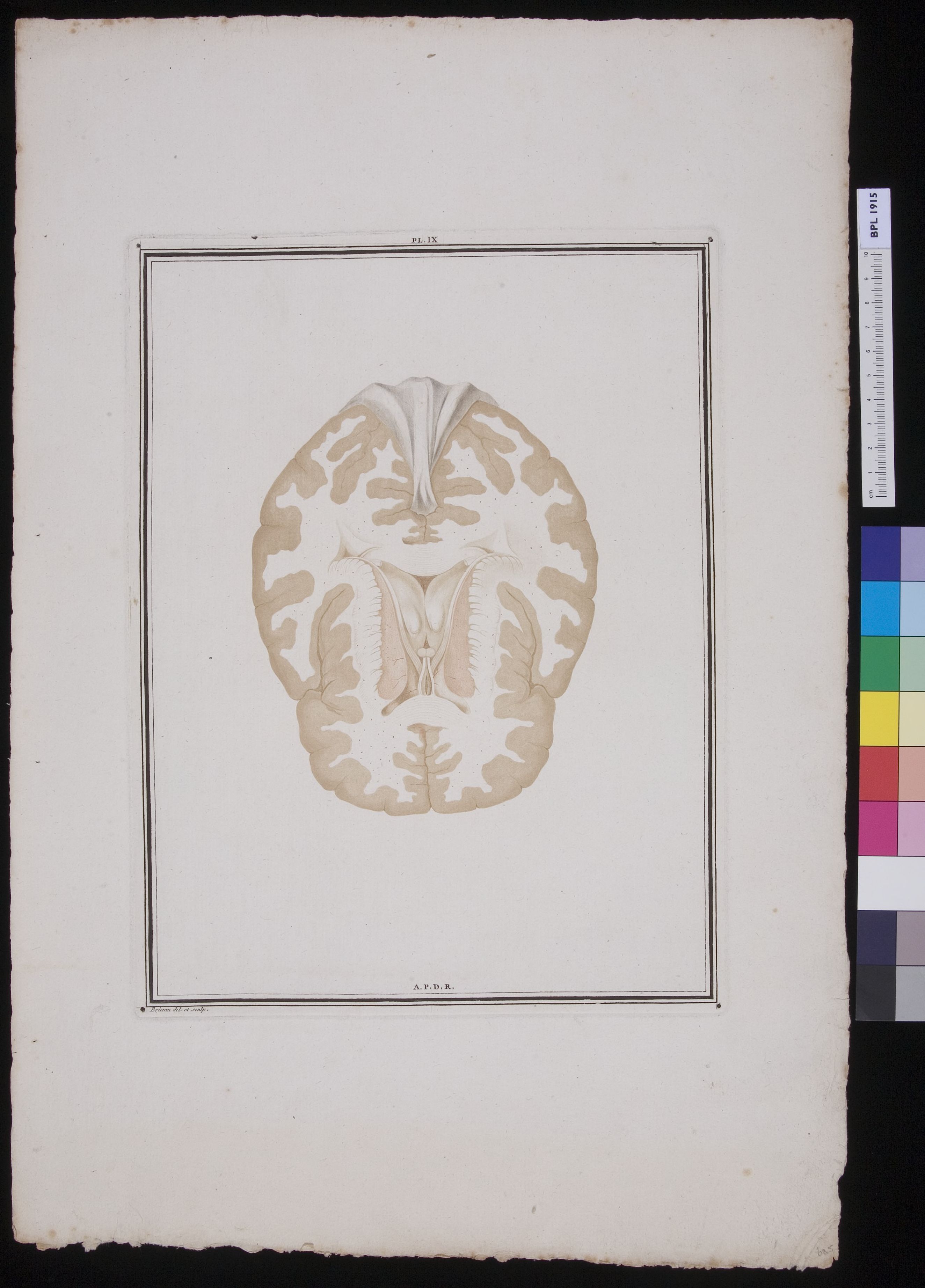 Section of the brain