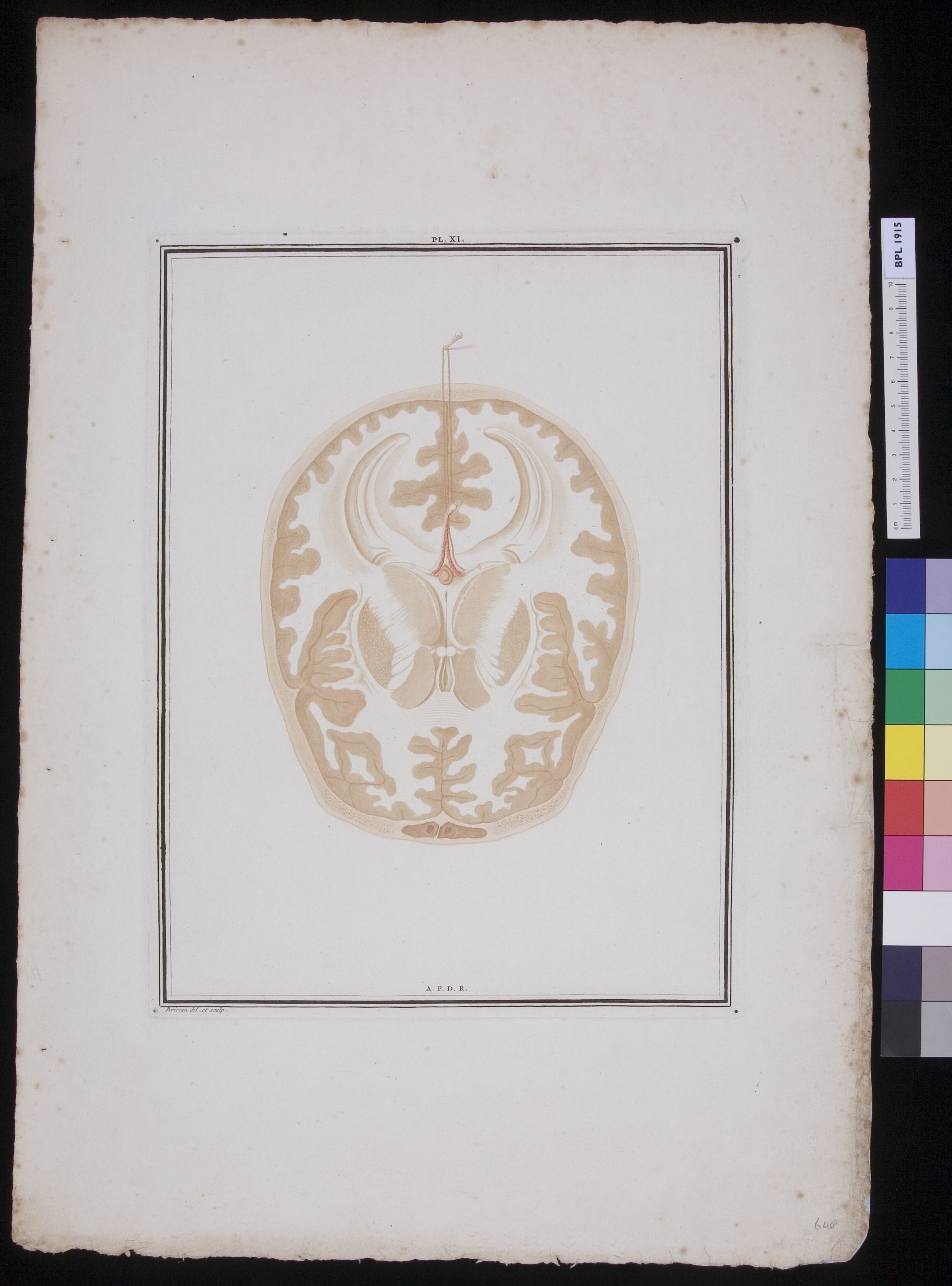 Section of the brain