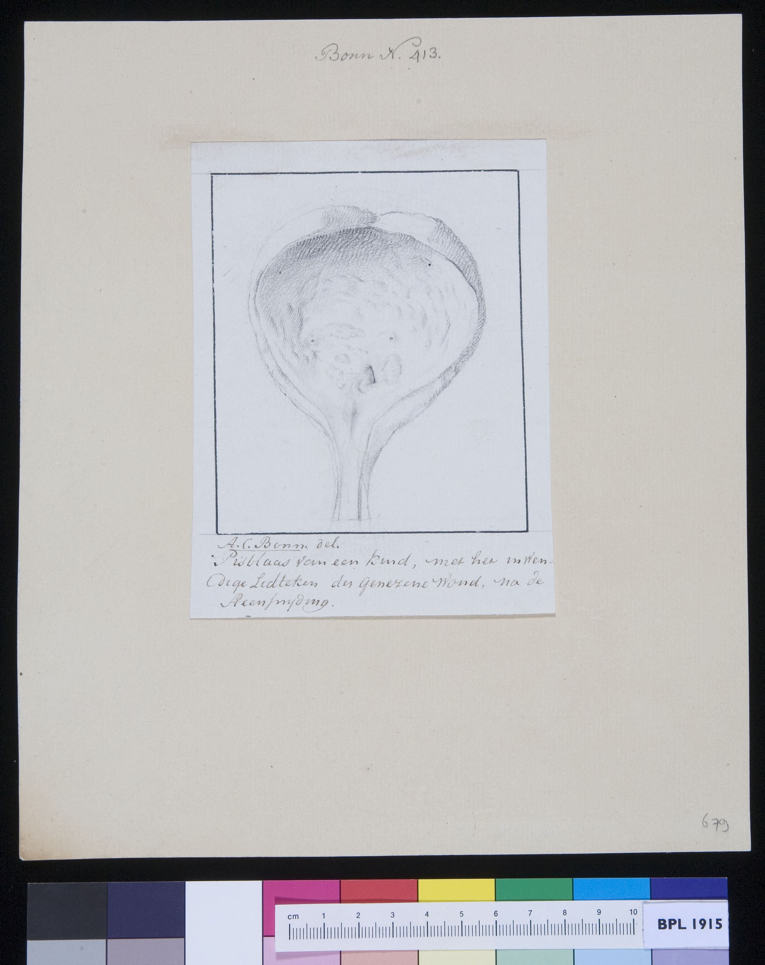 Bladder of a child