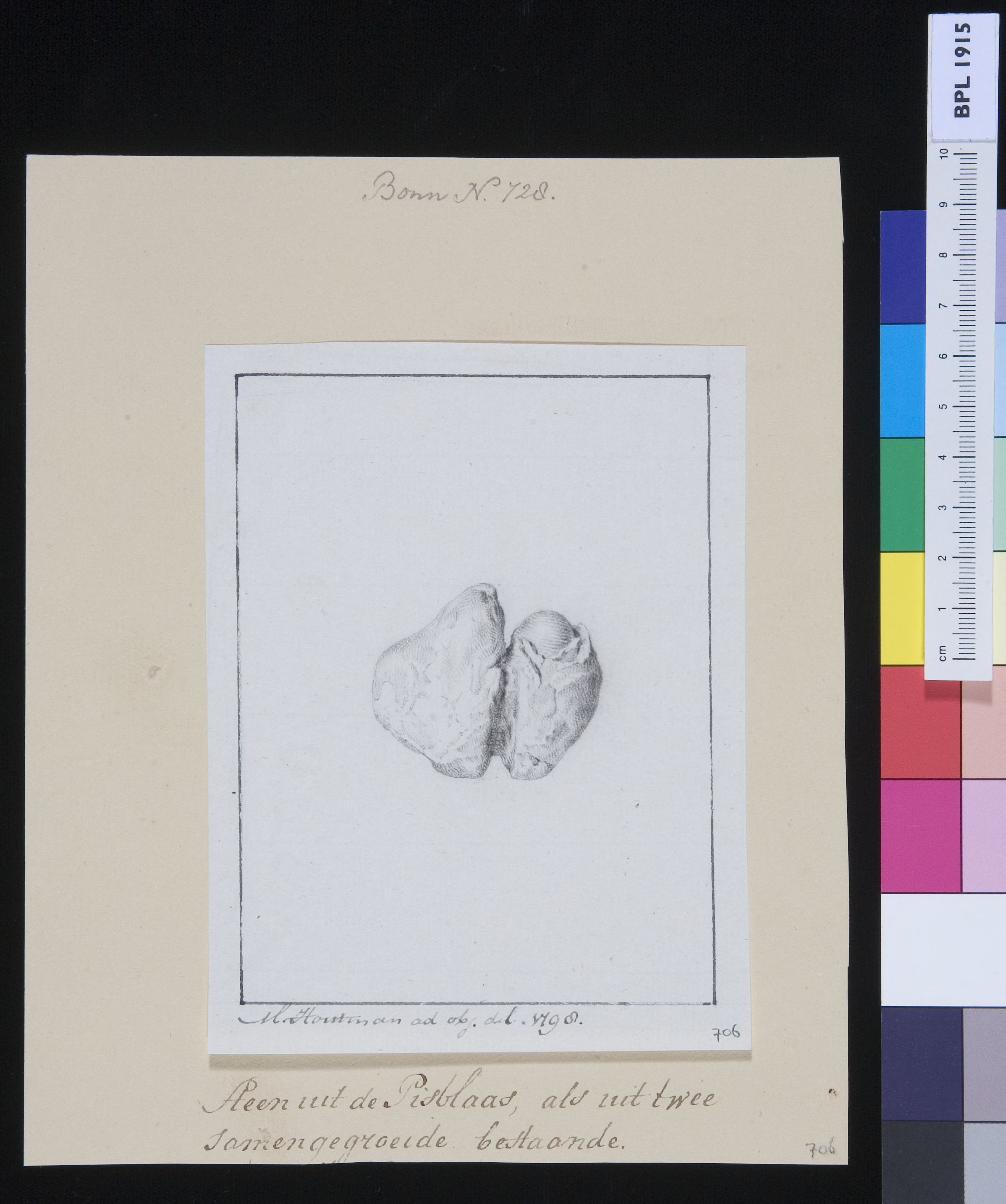 Stone from the bladder