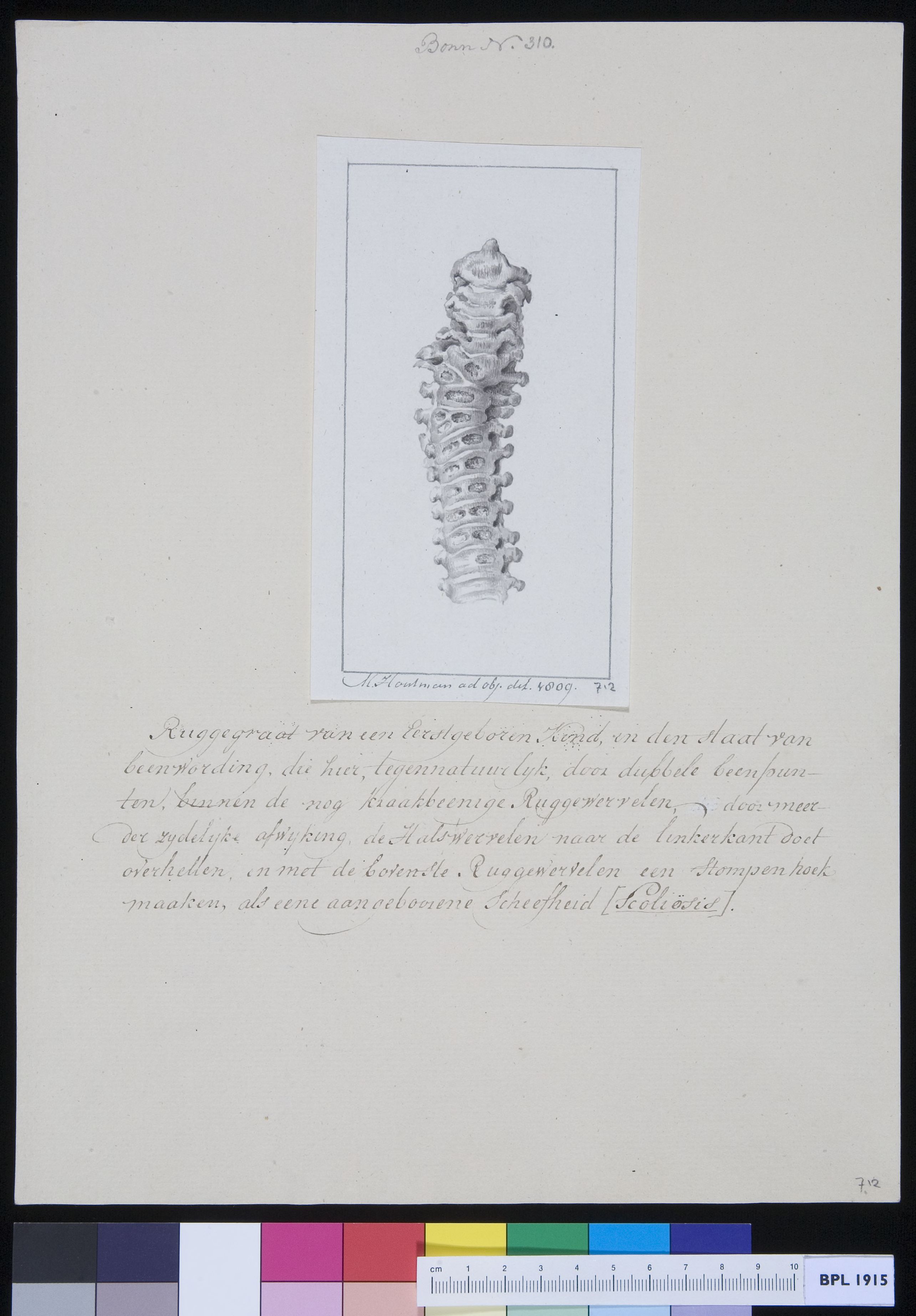 Vertebrae