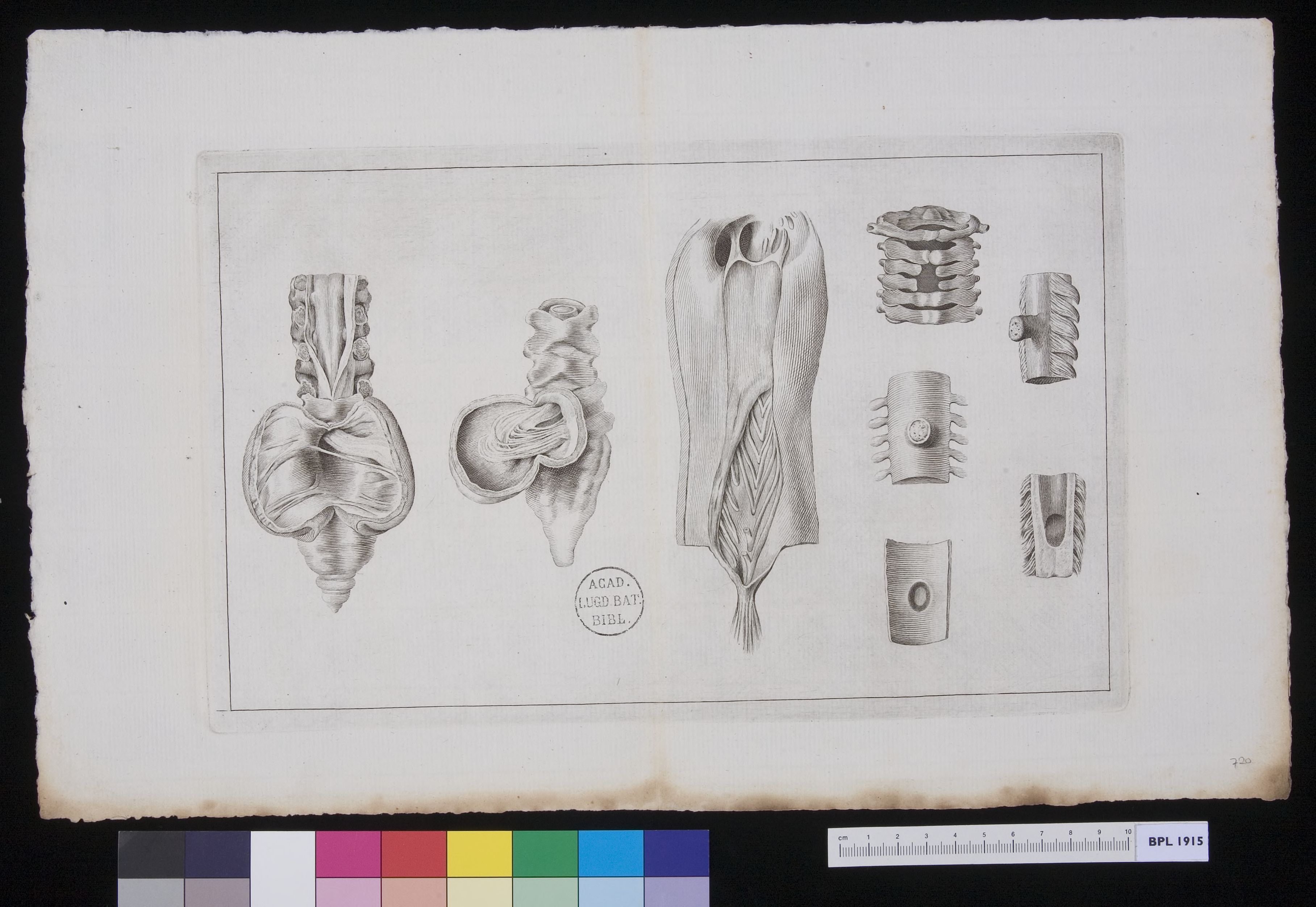 Vertebrae: infections