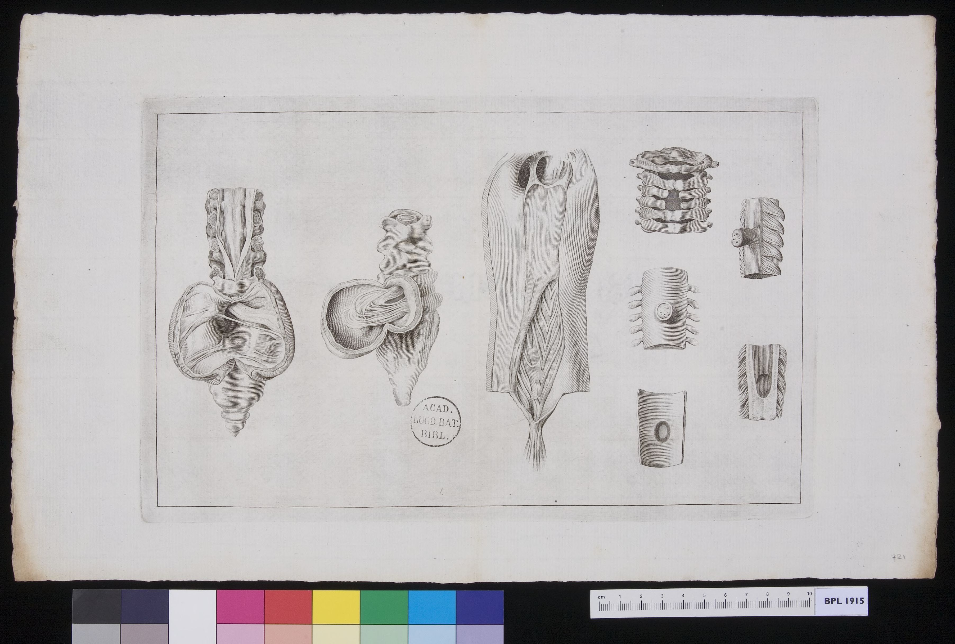 Vertebrae: infections