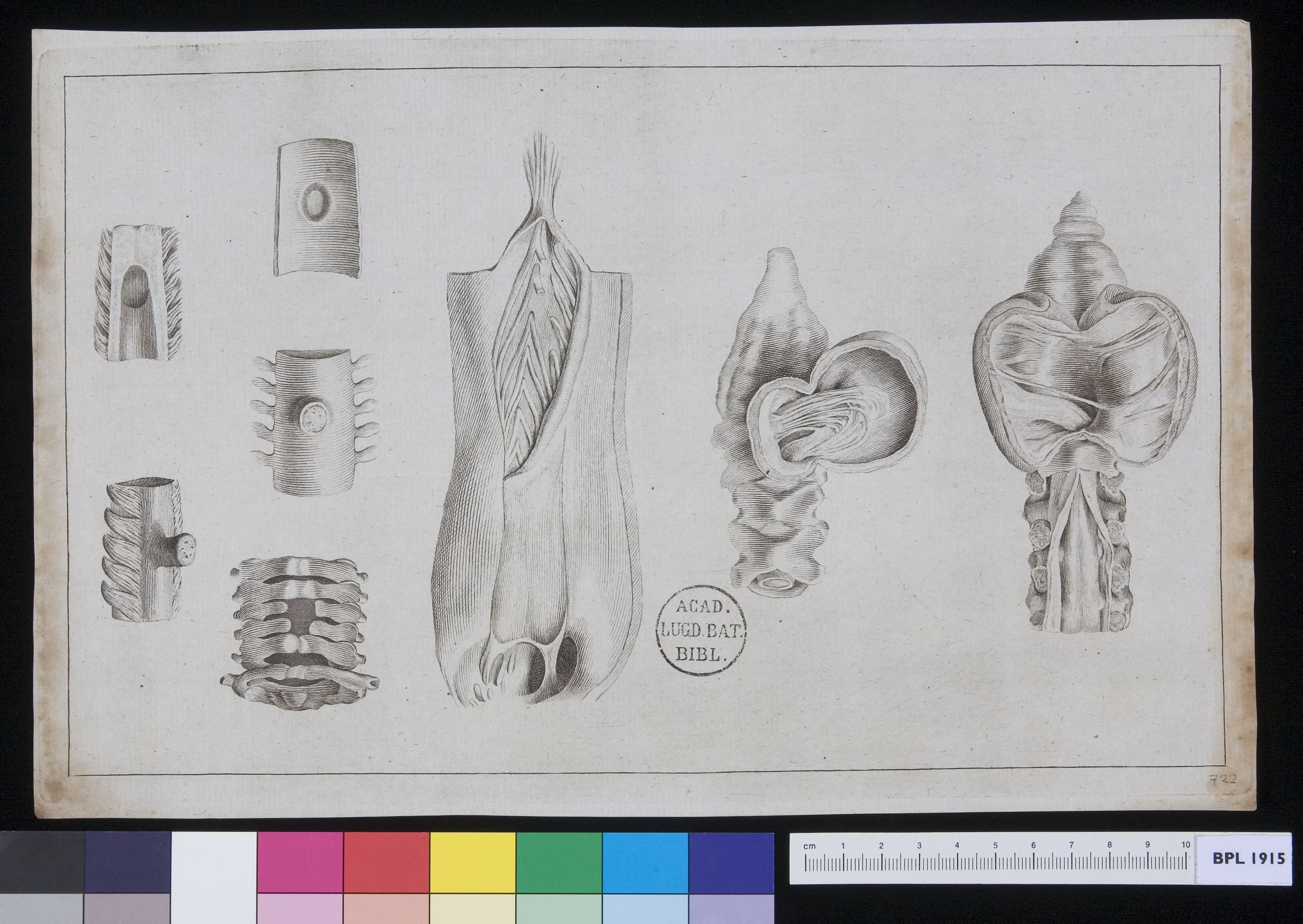 Vertebrae: infections