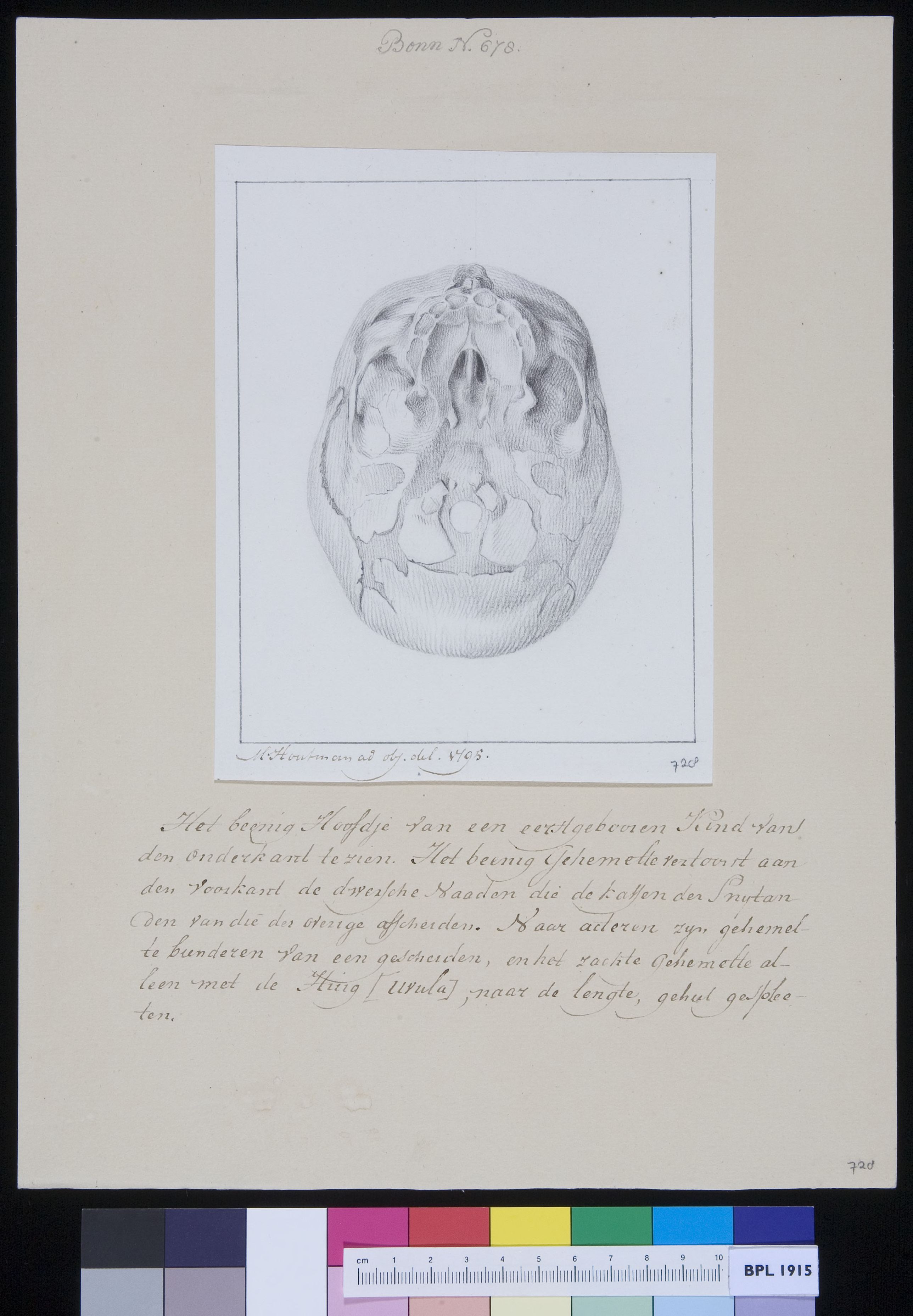 Skull of a child, seen from below, showing the position of the teeth