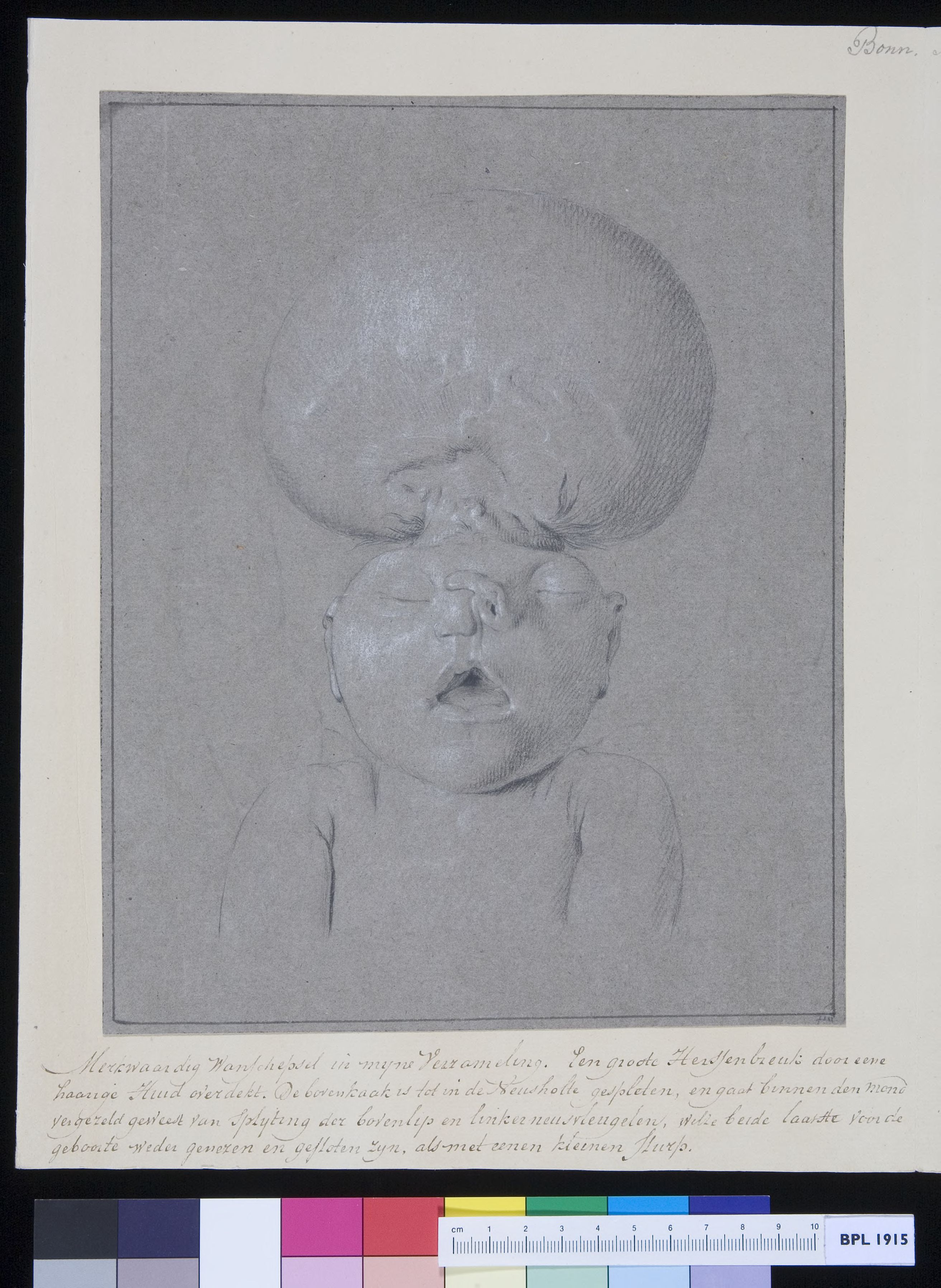 Deformed child