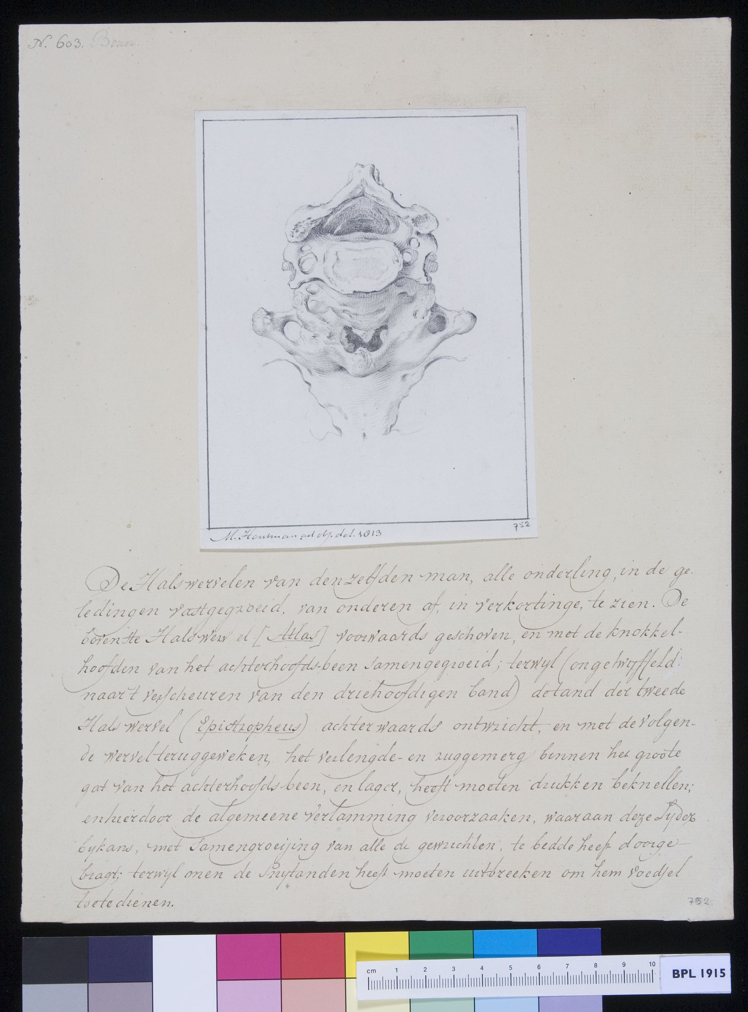 Vertebrae